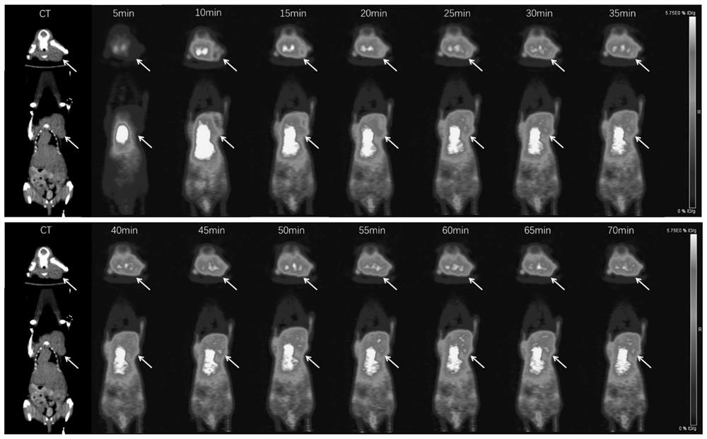 Radioisotope labeled polypeptide developer of targeted transferrin receptor and application of radioisotope labeled polypeptide developer