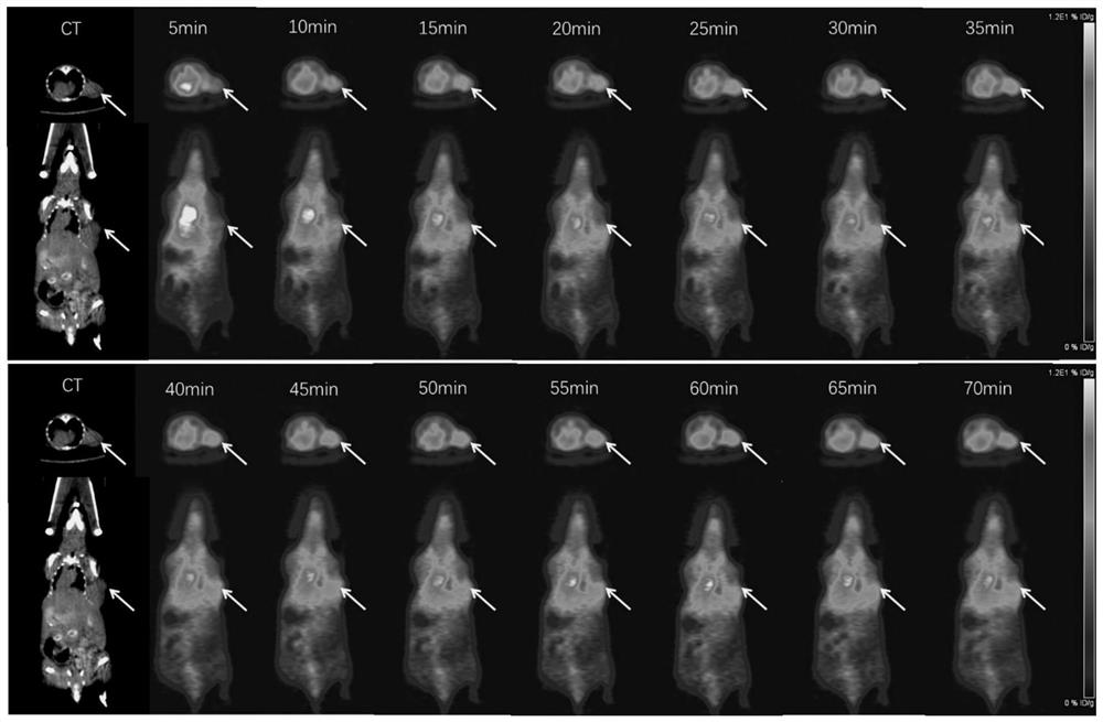 Radioisotope labeled polypeptide developer of targeted transferrin receptor and application of radioisotope labeled polypeptide developer