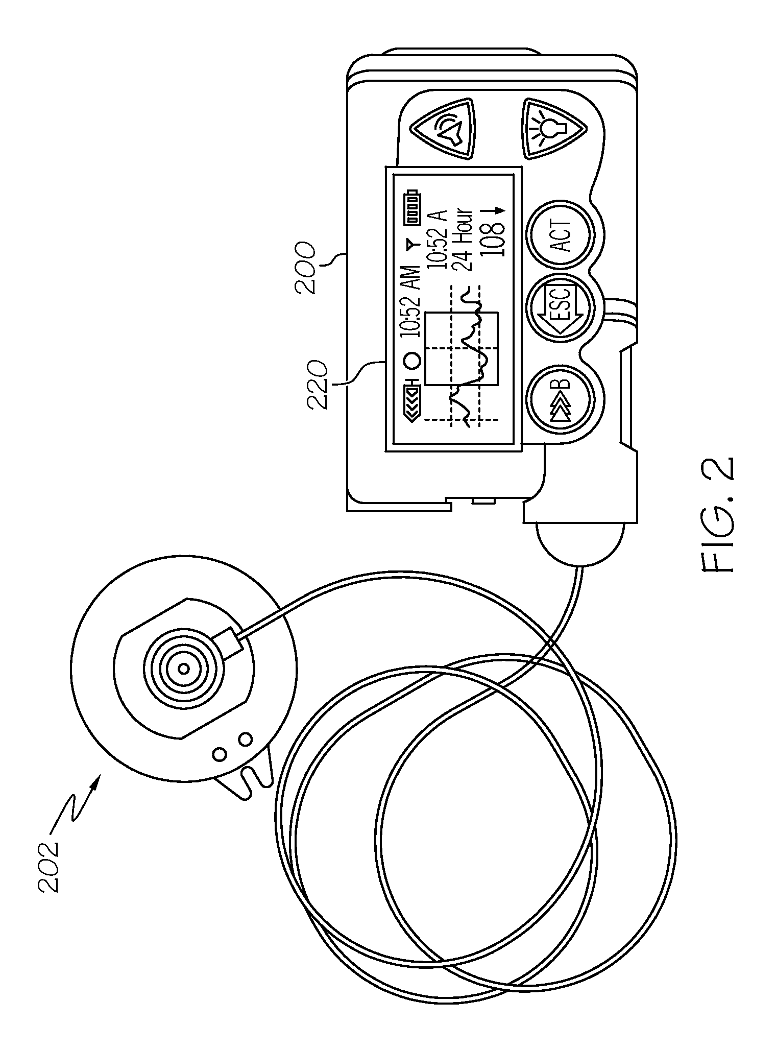 Omnidirectional accelerometer device and medical device incorporating same