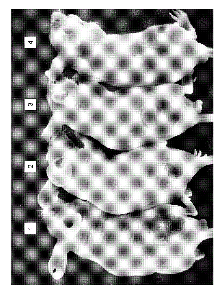 Liposome containing shRNA molecule for thymidylate synthase, and use for same