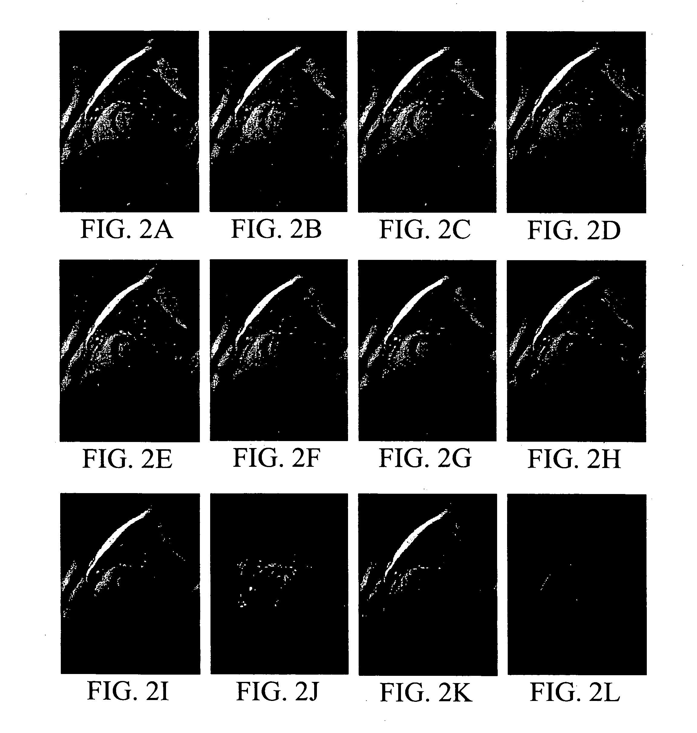 Technique for parallel MRI imaging (k-t grappa)