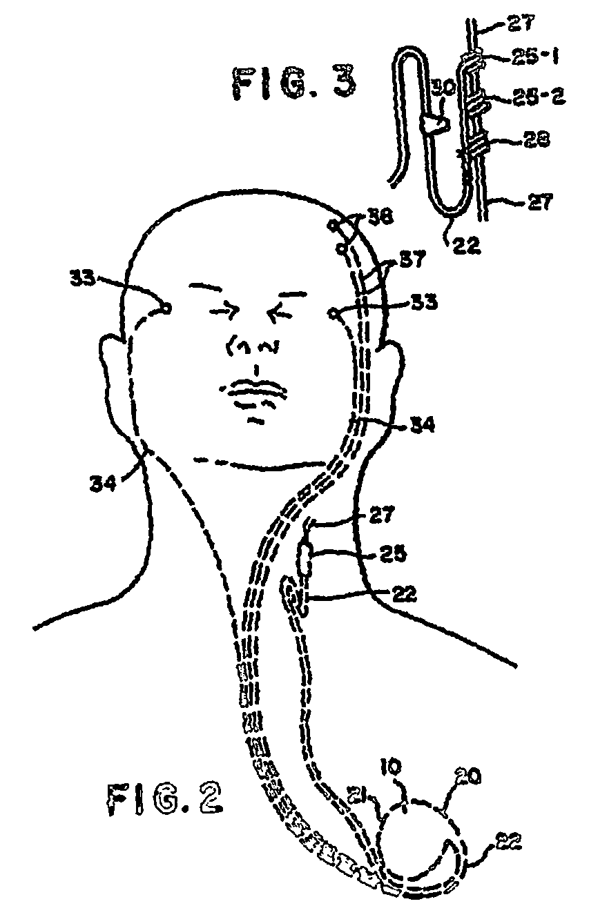 Cervical vagal stimulation induced weight loss