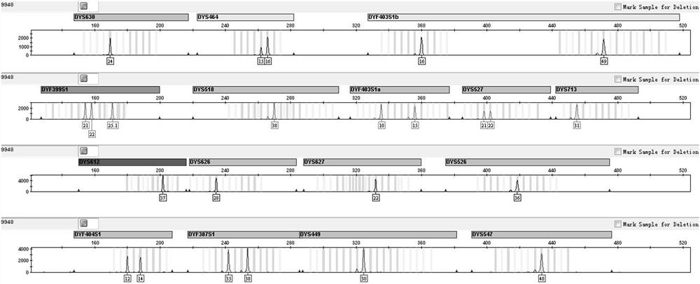 Compound amplification system, kit and application of rapidly mutating y-chromosomal short tandem repeats