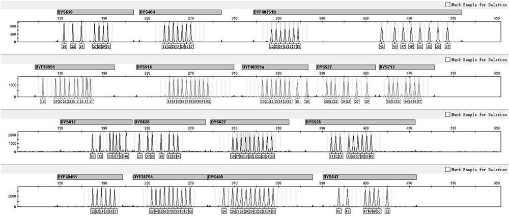 Compound amplification system, kit and application of rapidly mutating y-chromosomal short tandem repeats