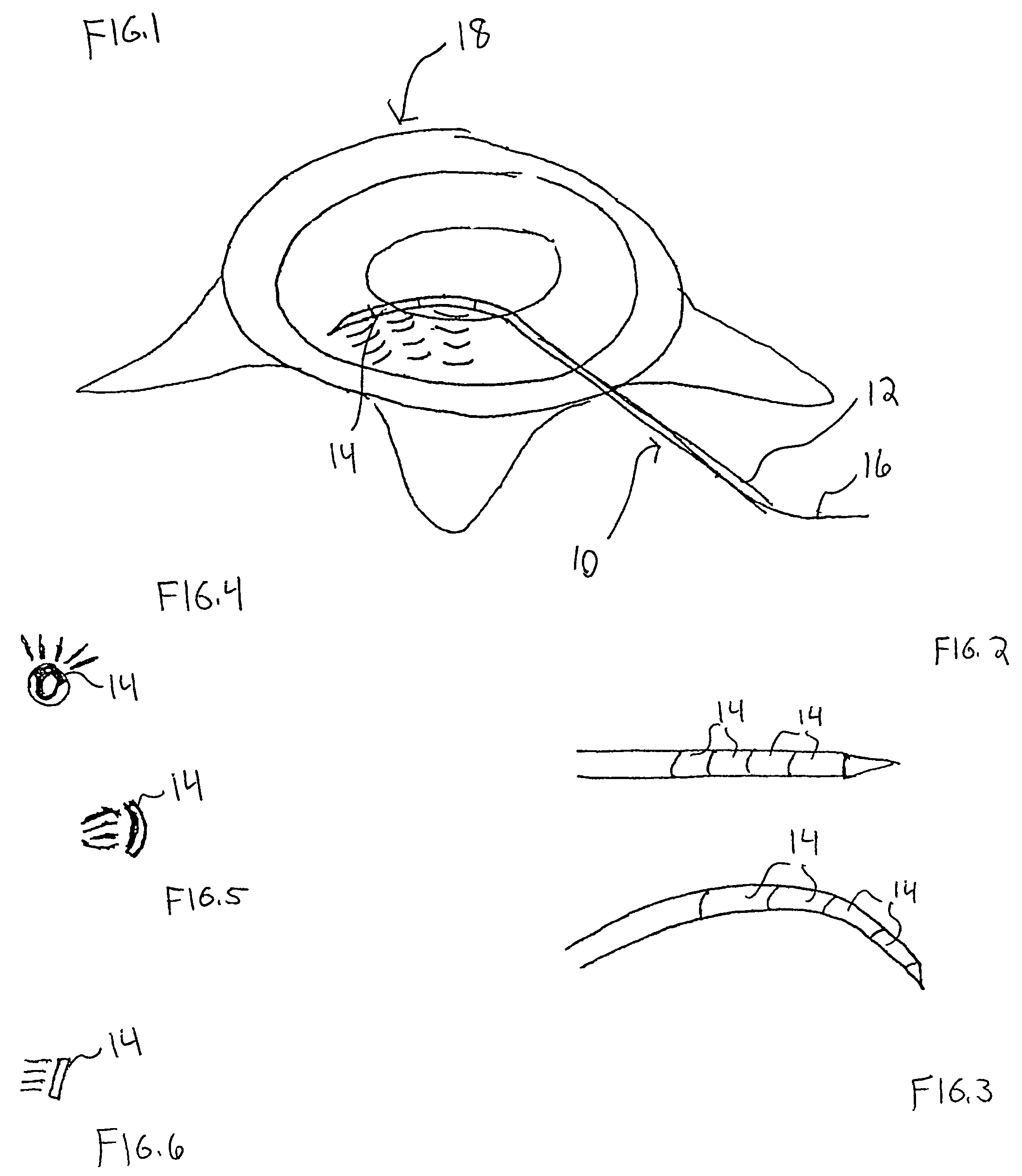 Ultrasound device for treatment of intervertebral disc