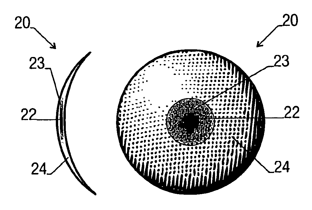 Contact lens for treating binocular diplopia