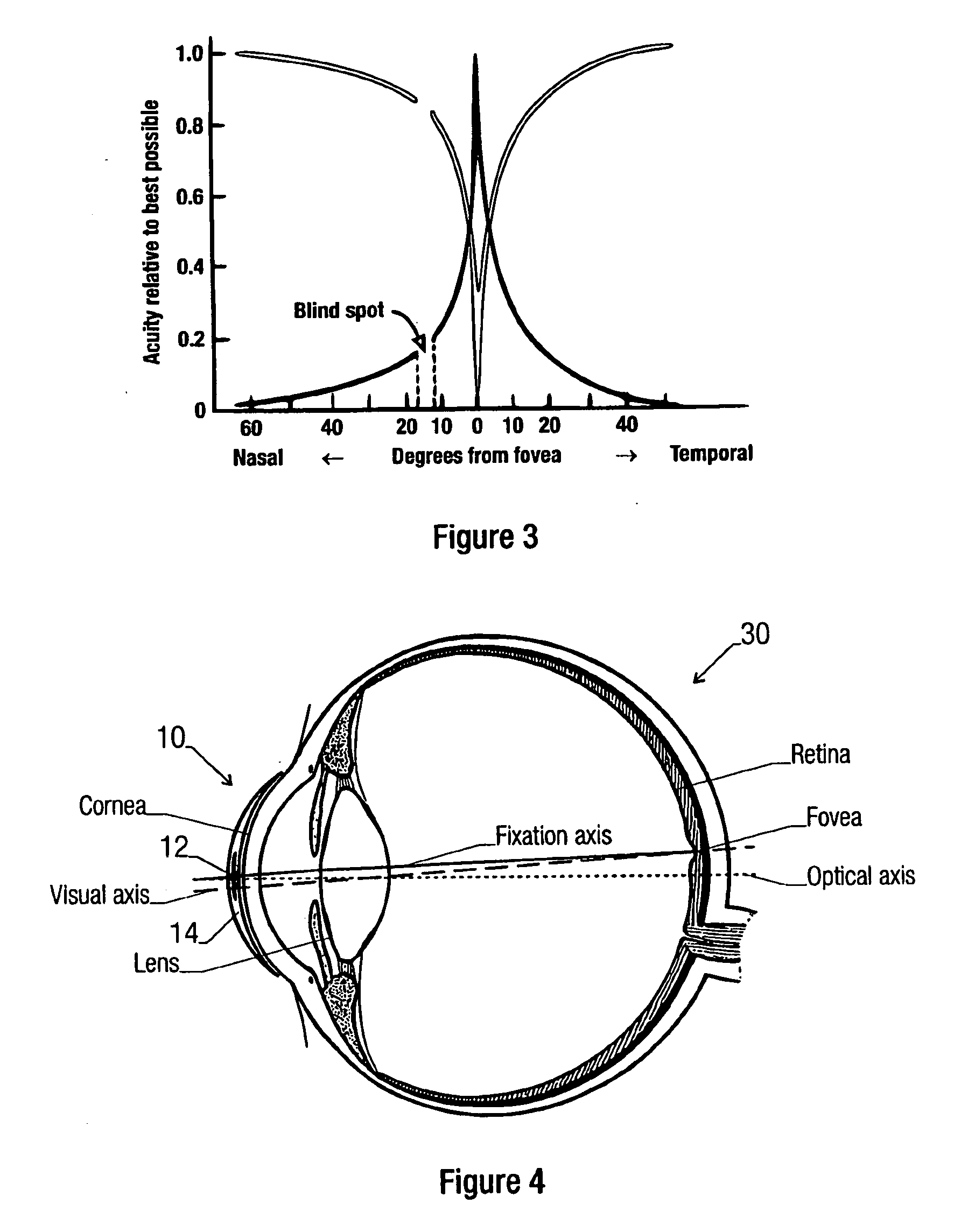 Contact lens for treating binocular diplopia