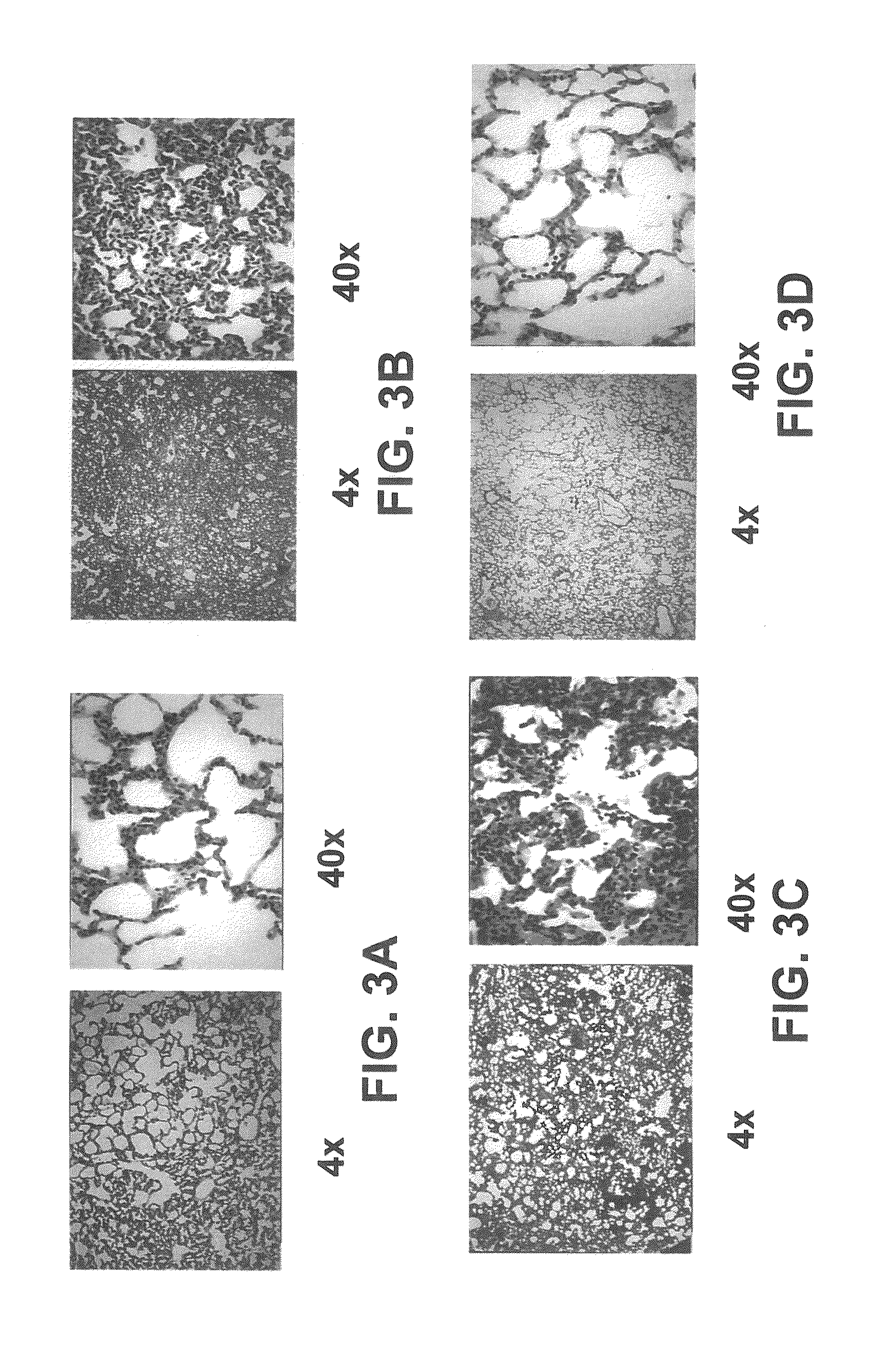 Albumin-based colloid composition and method of use in treating hypovolemia and multiorgan dysfunction