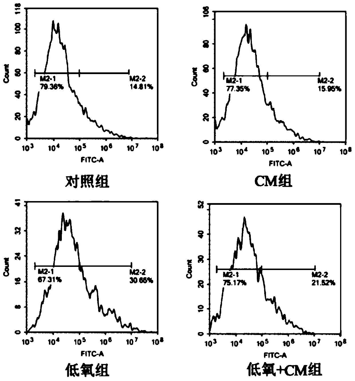 Dental pulp stem cell conditioned medium and preparation method and application thereof