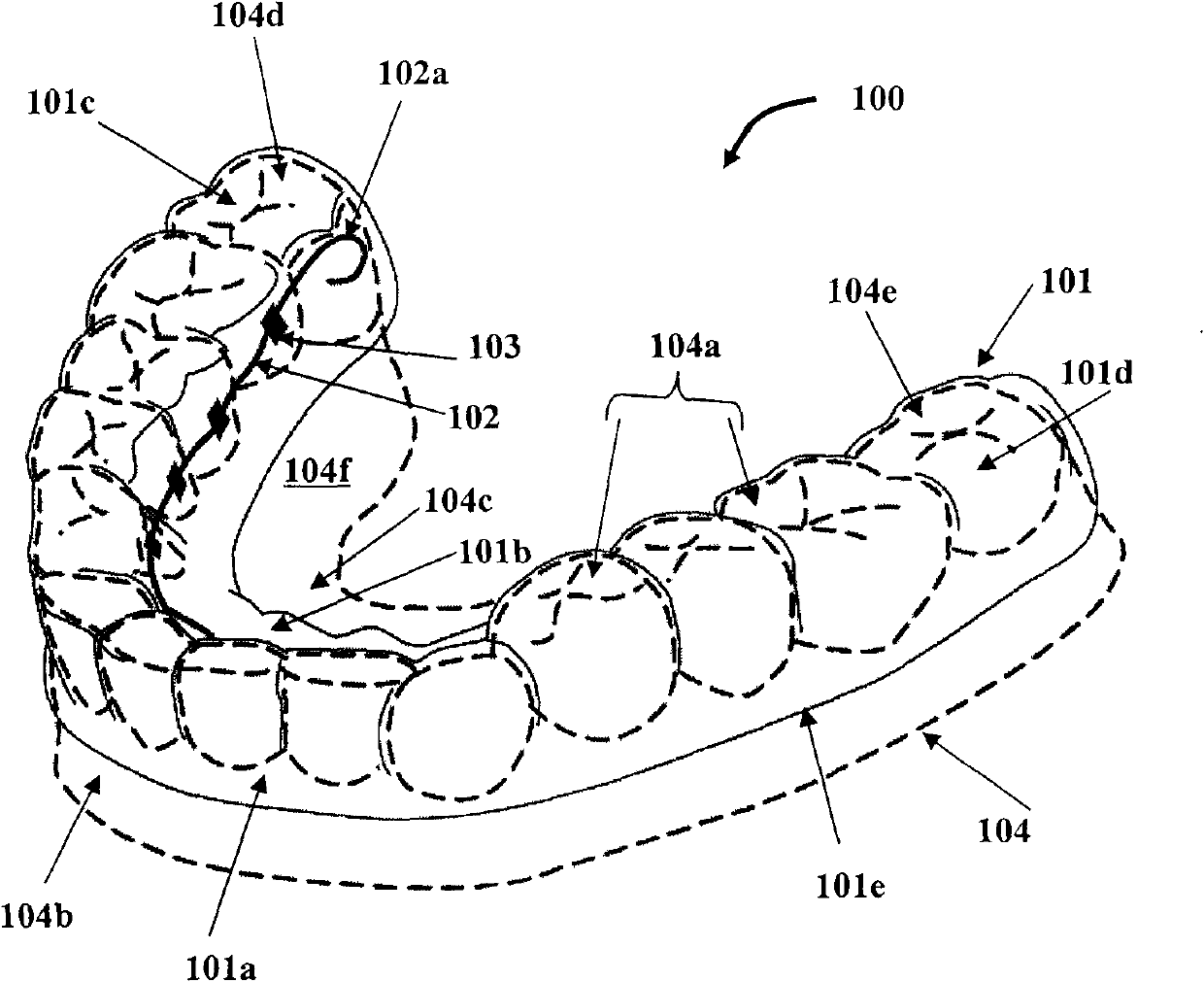 Movable tooth corrector and manufacture method