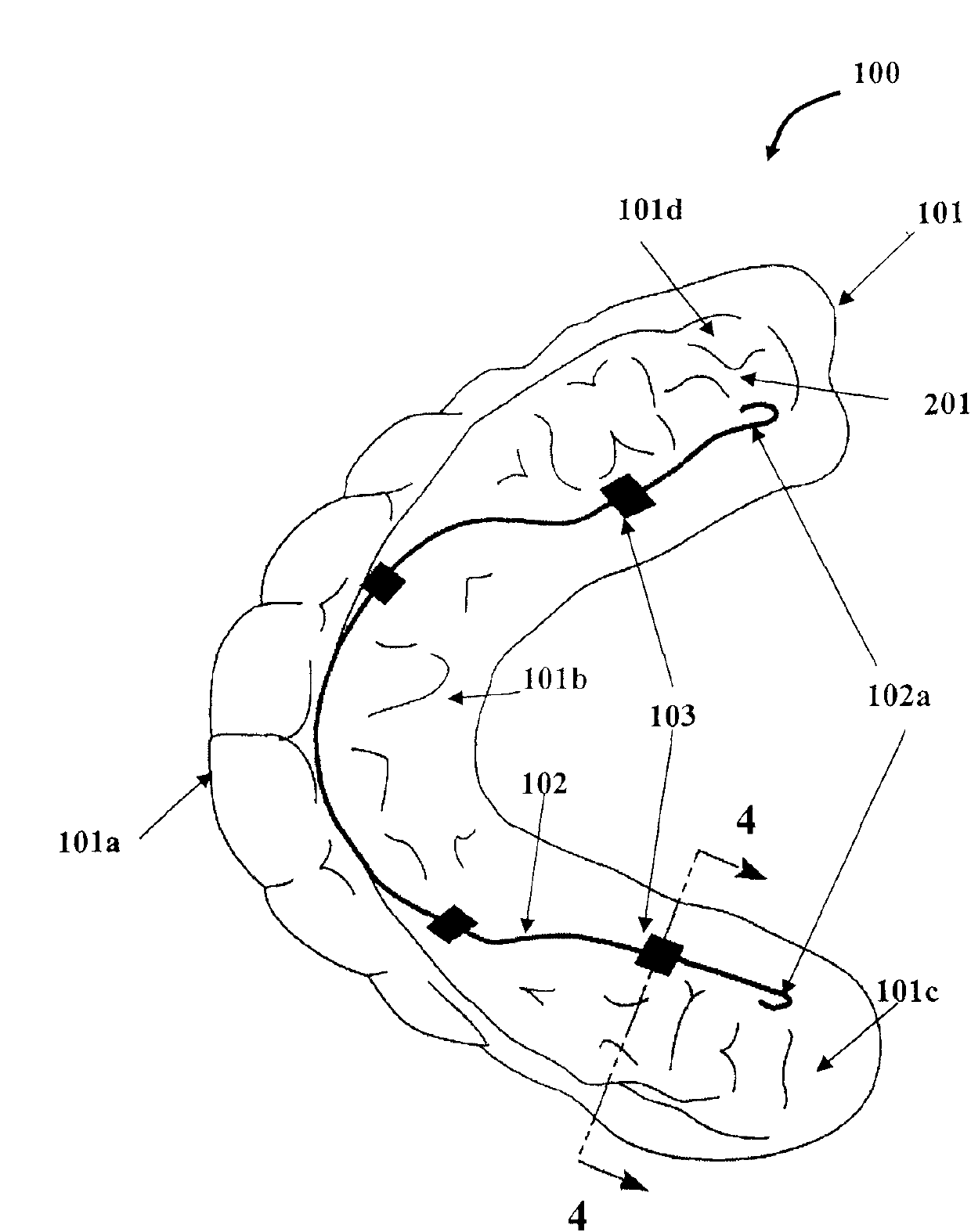 Movable tooth corrector and manufacture method