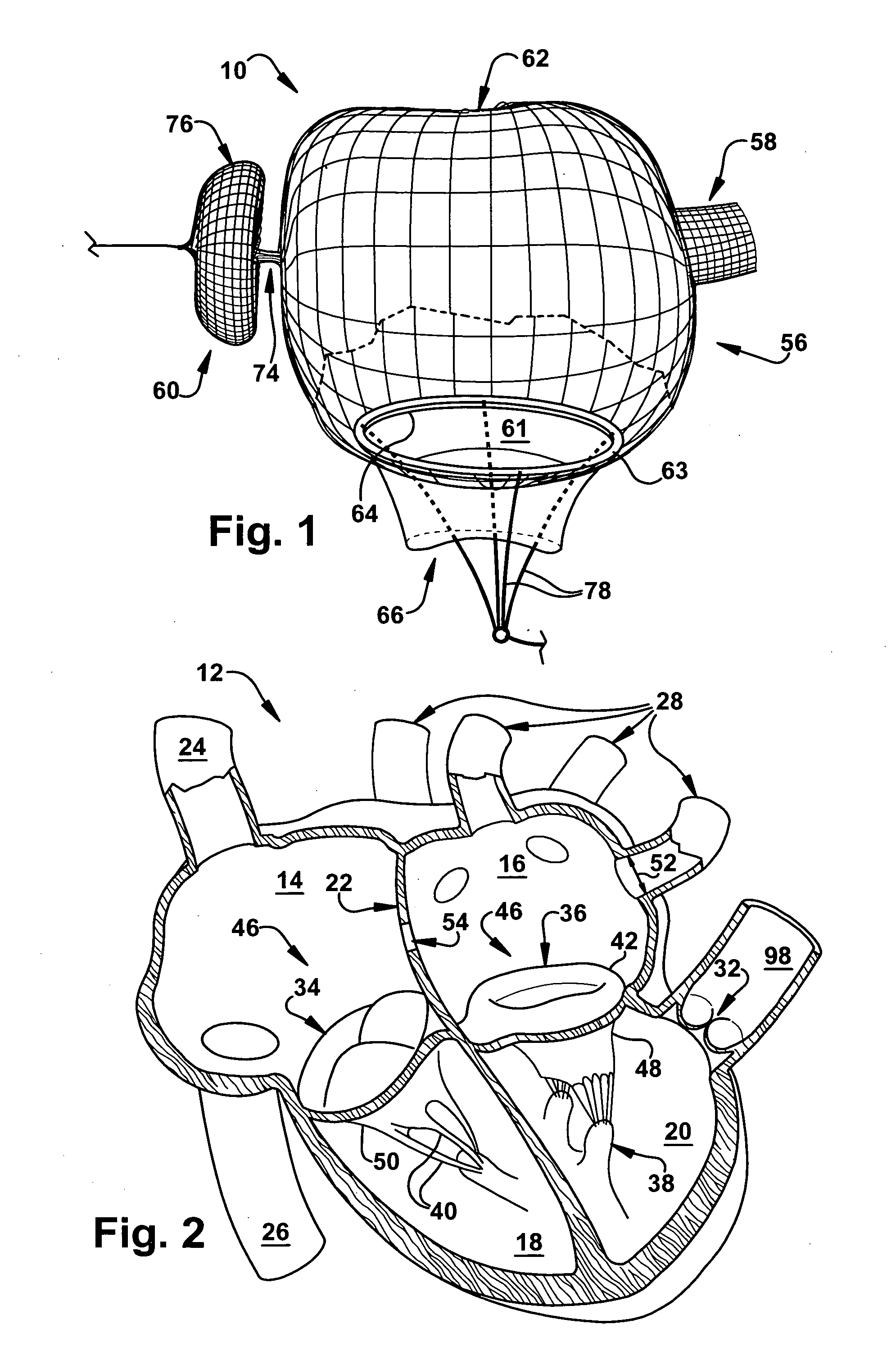 Percutaneous atrioventricular valve and method of use