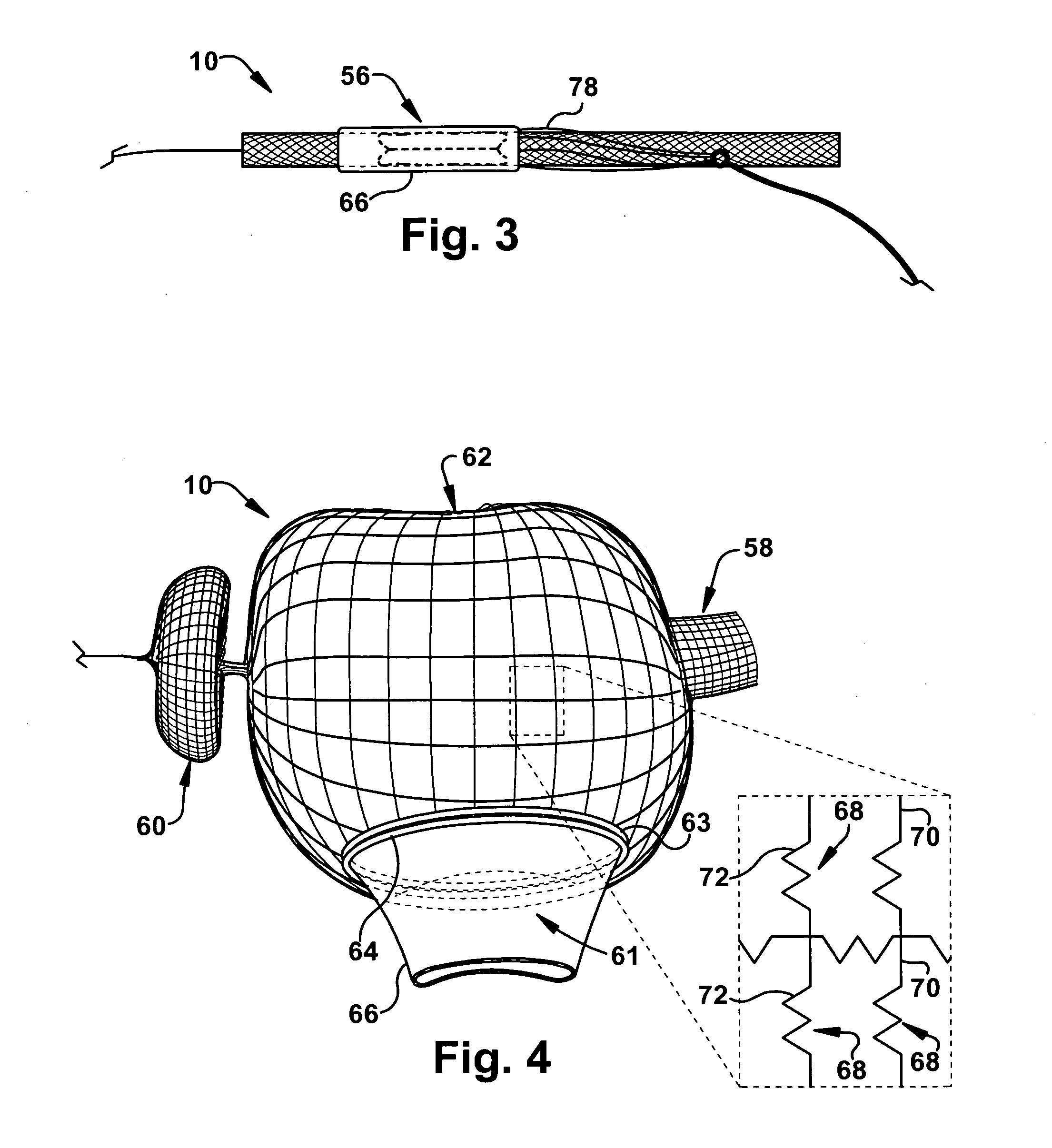 Percutaneous atrioventricular valve and method of use