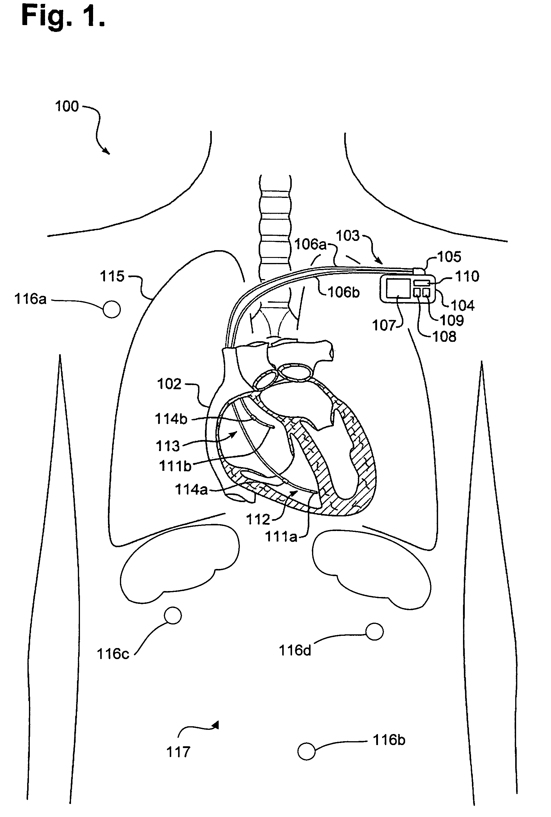 System and method for providing digital data communications over a wireless intra-body network