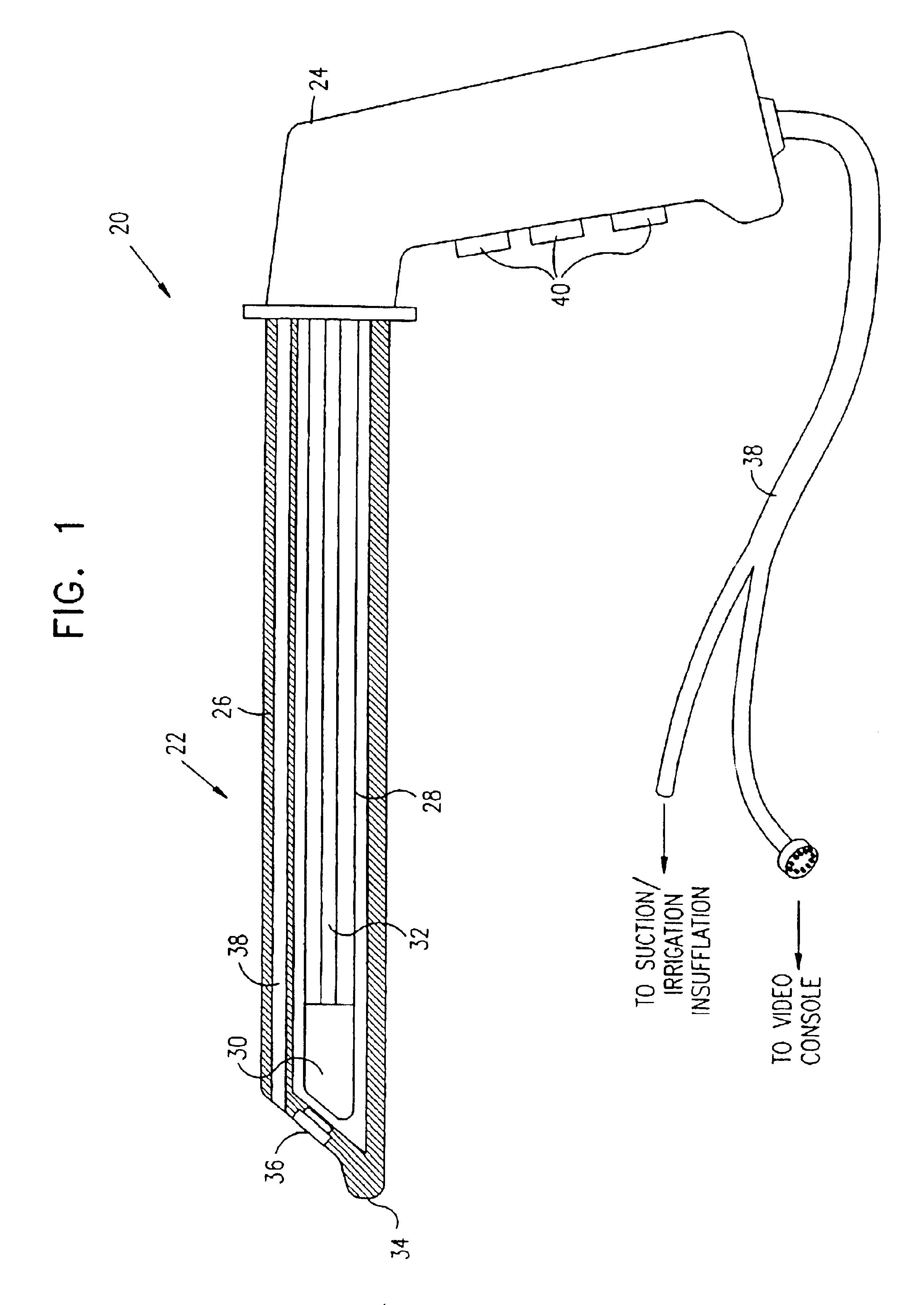 Method for insertion of an endoscope into the colon