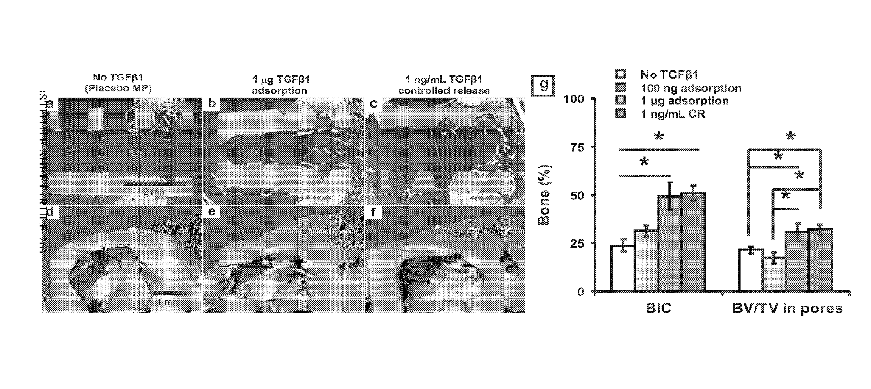 Porous implants and stents as controlled release drug delivery carriers