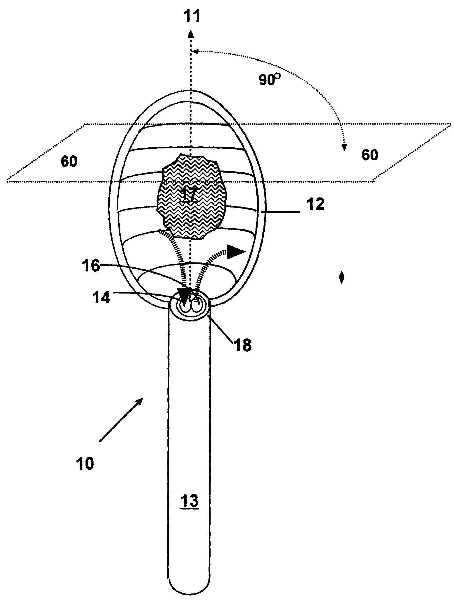 Methods and devices for the in situ dissolution of renal calculi