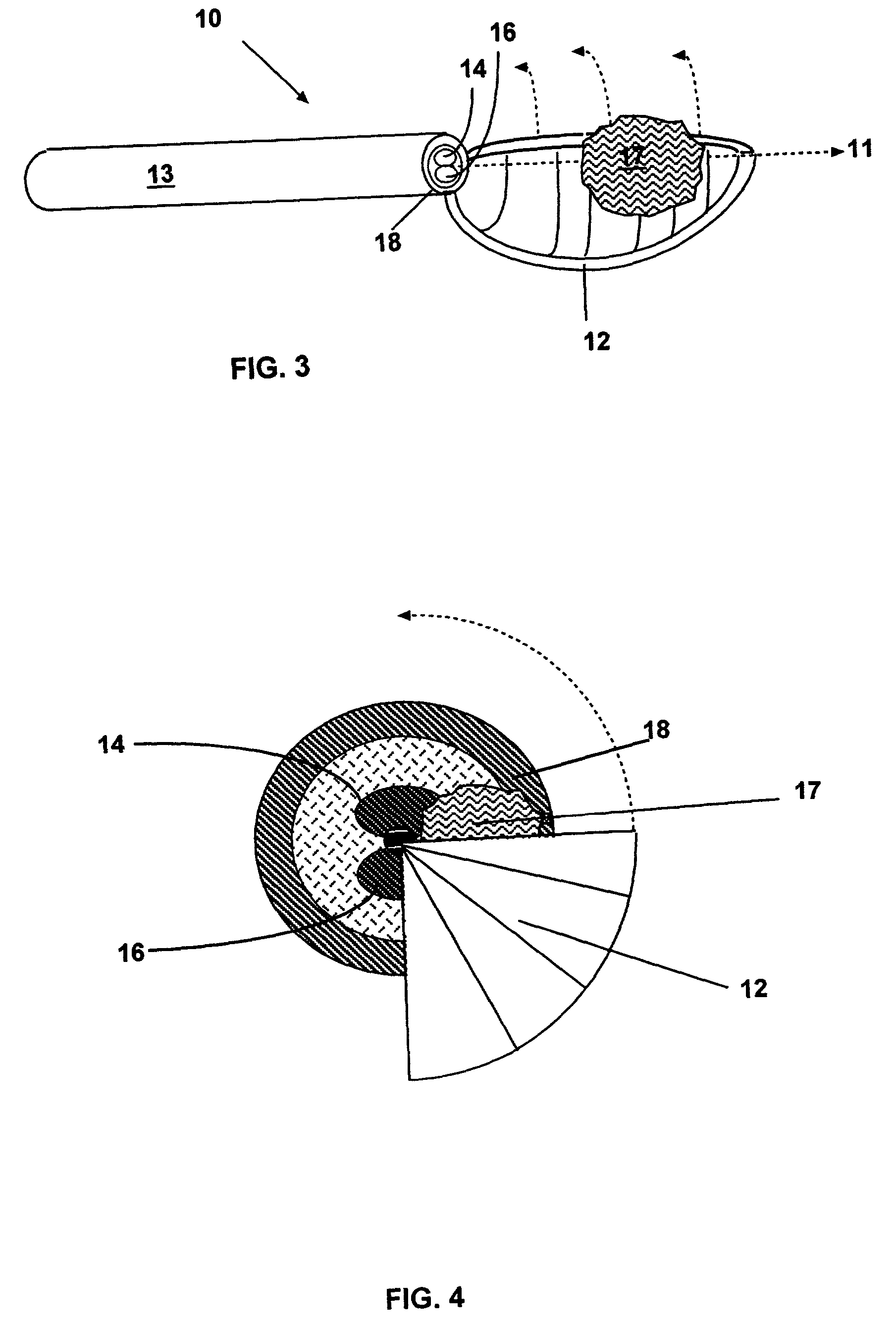 Methods and devices for the in situ dissolution of renal calculi