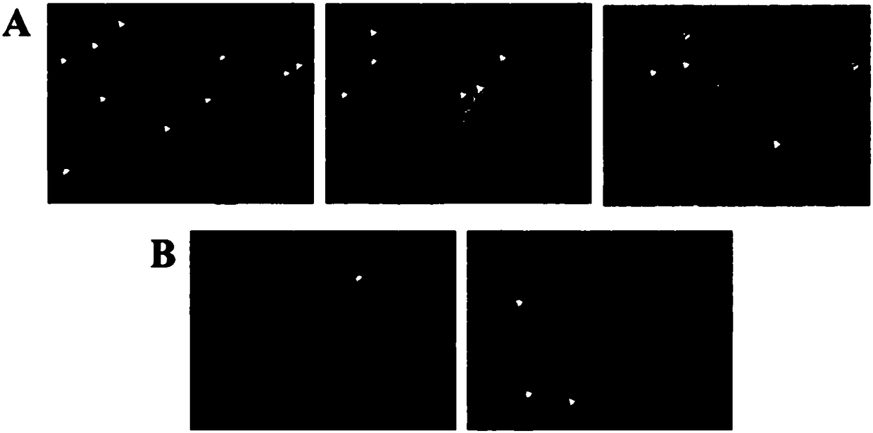 Injectable polymer hydrogel based on acylhydrazone bond, preparation method thereof and polymer hydrogel injection