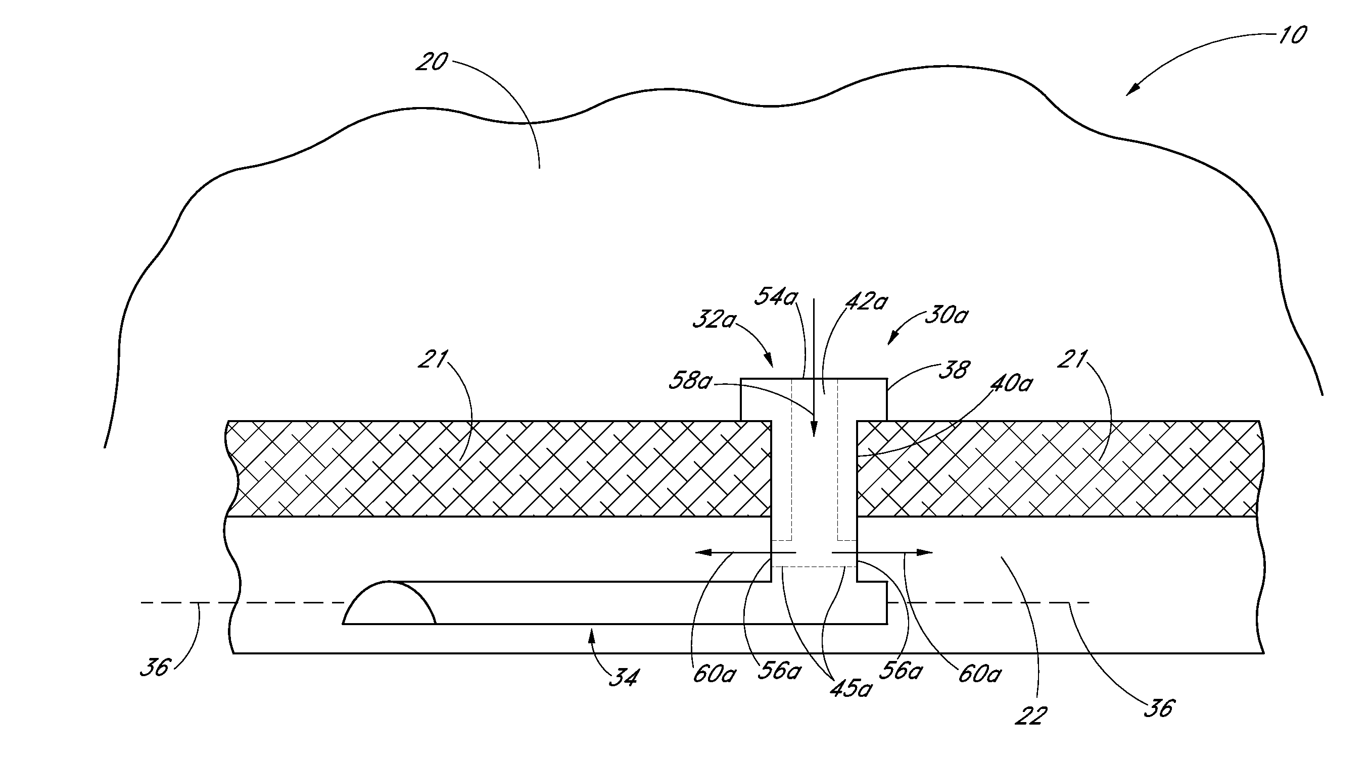 Glaucoma stent and methods thereof for glaucoma treatment