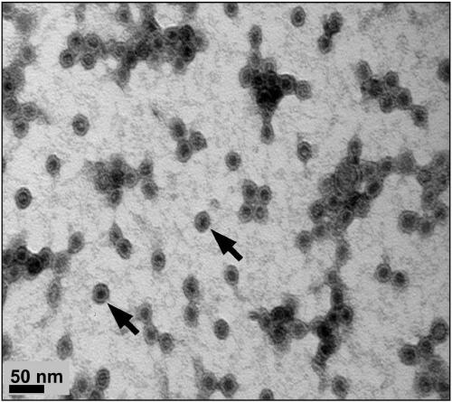 Pasteurella multocida toxin recombinant protein, virus-like particle thereof and use thereof