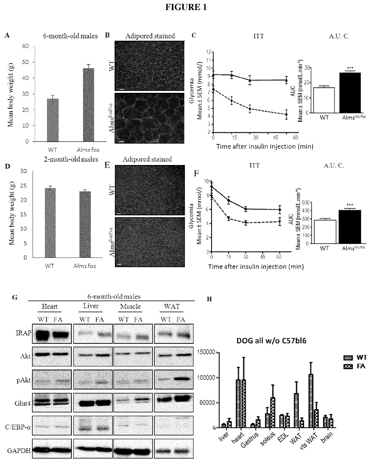 Target for diabetes treatment and prevention