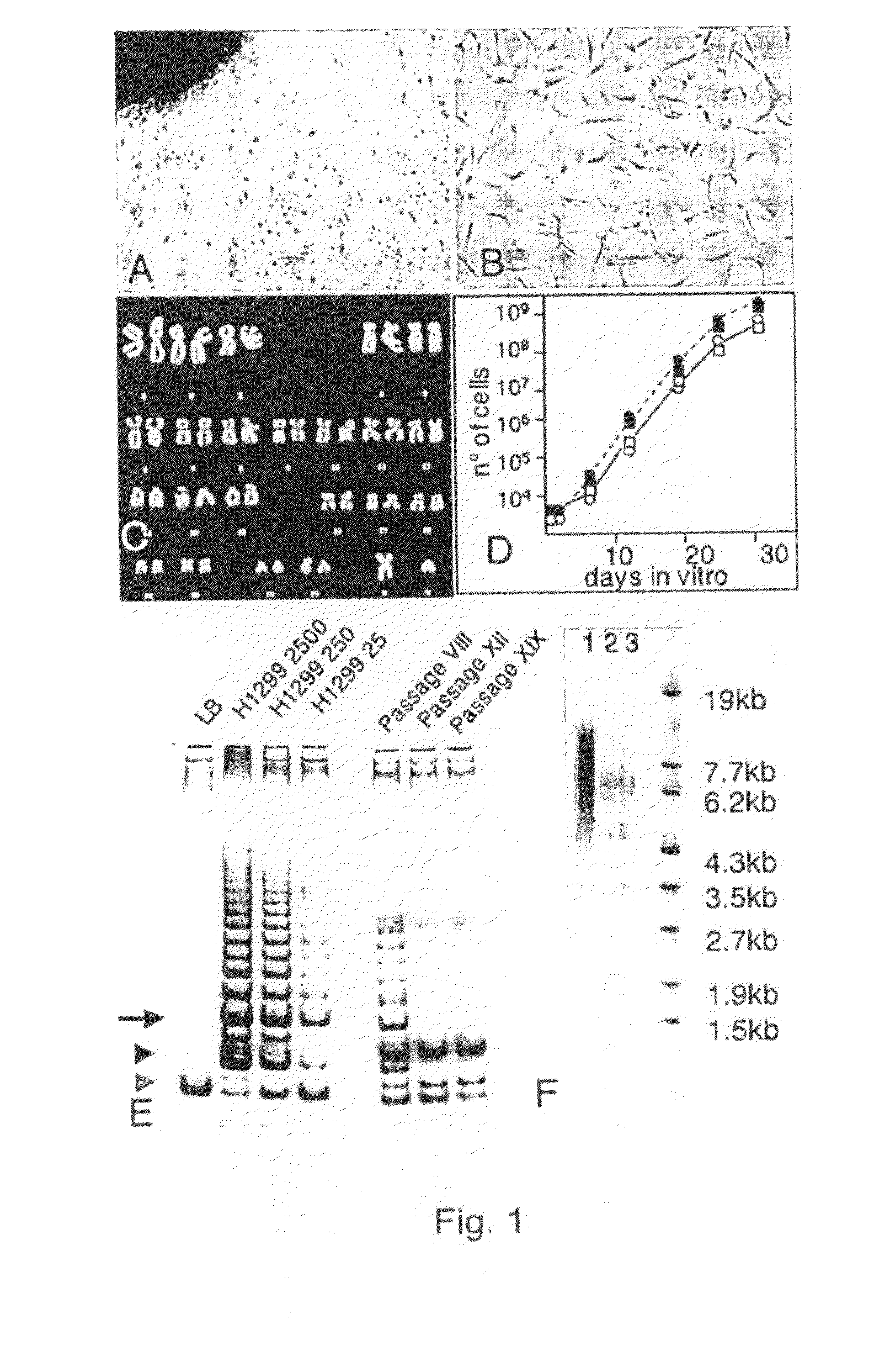 Skeletal muscle periangioblasts and cardiac mesangioblasts, method for isolation and uses thereof