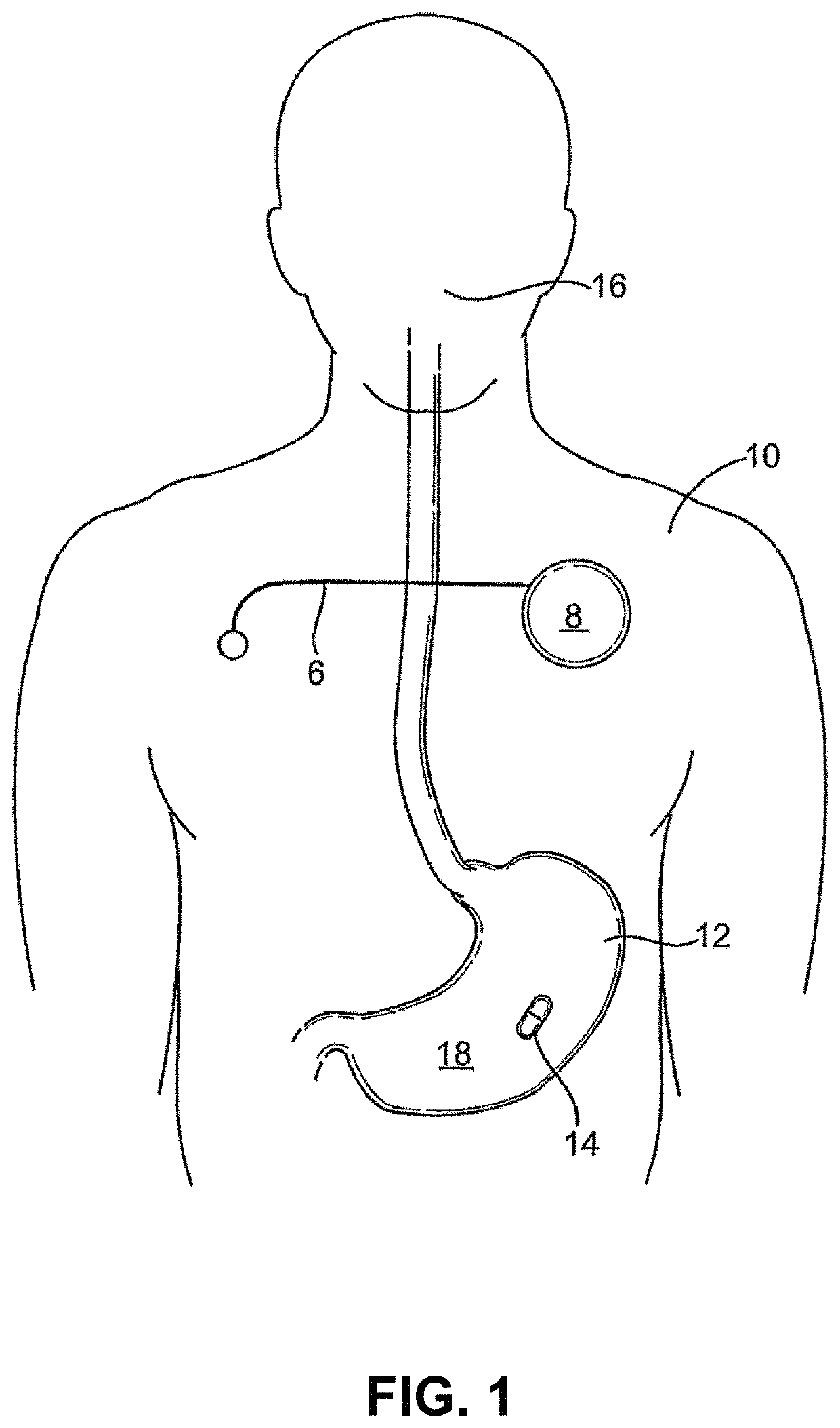 Lisinopril compositions with an ingestible event marker