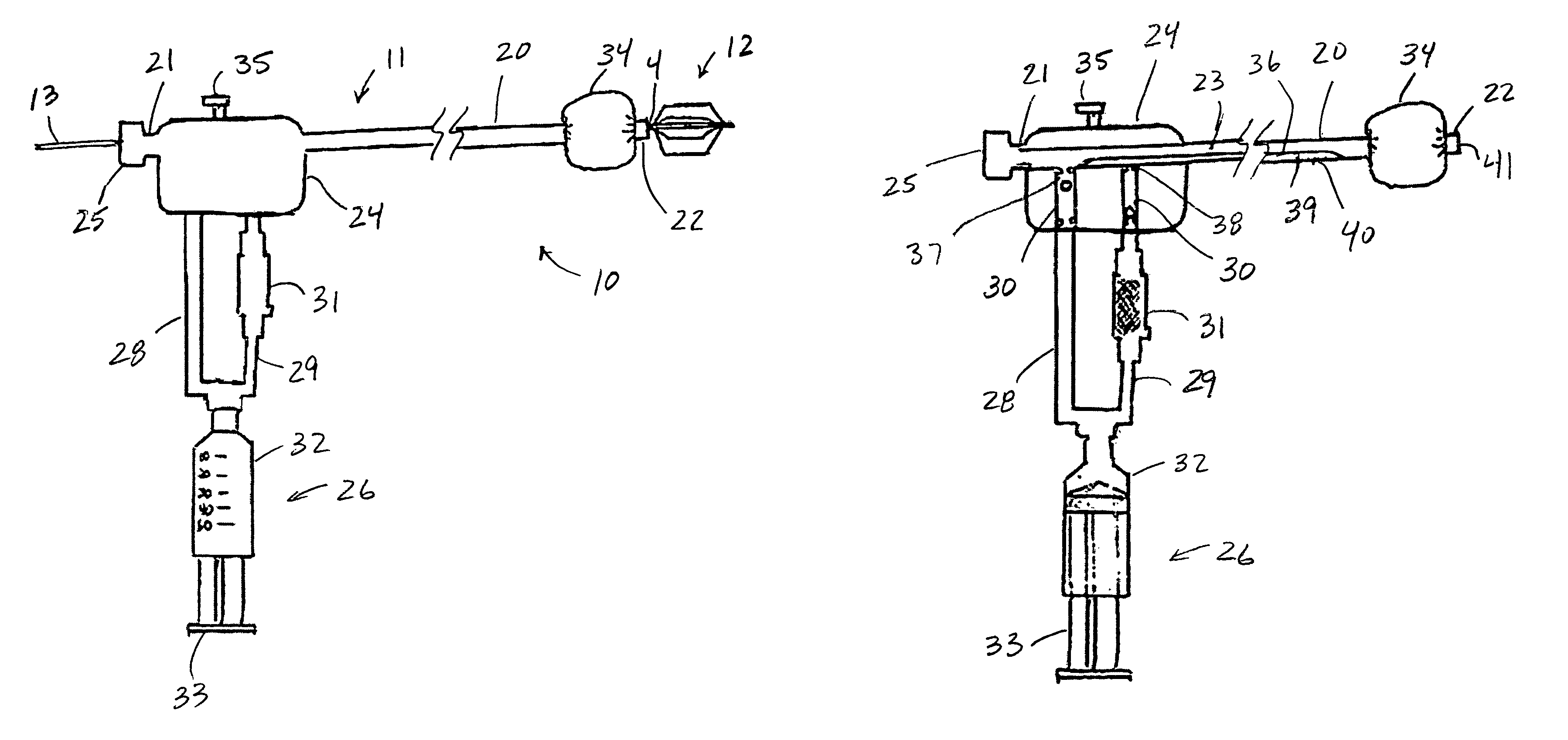 Embolic protection and plaque removal system with closed circuit aspiration and filtering