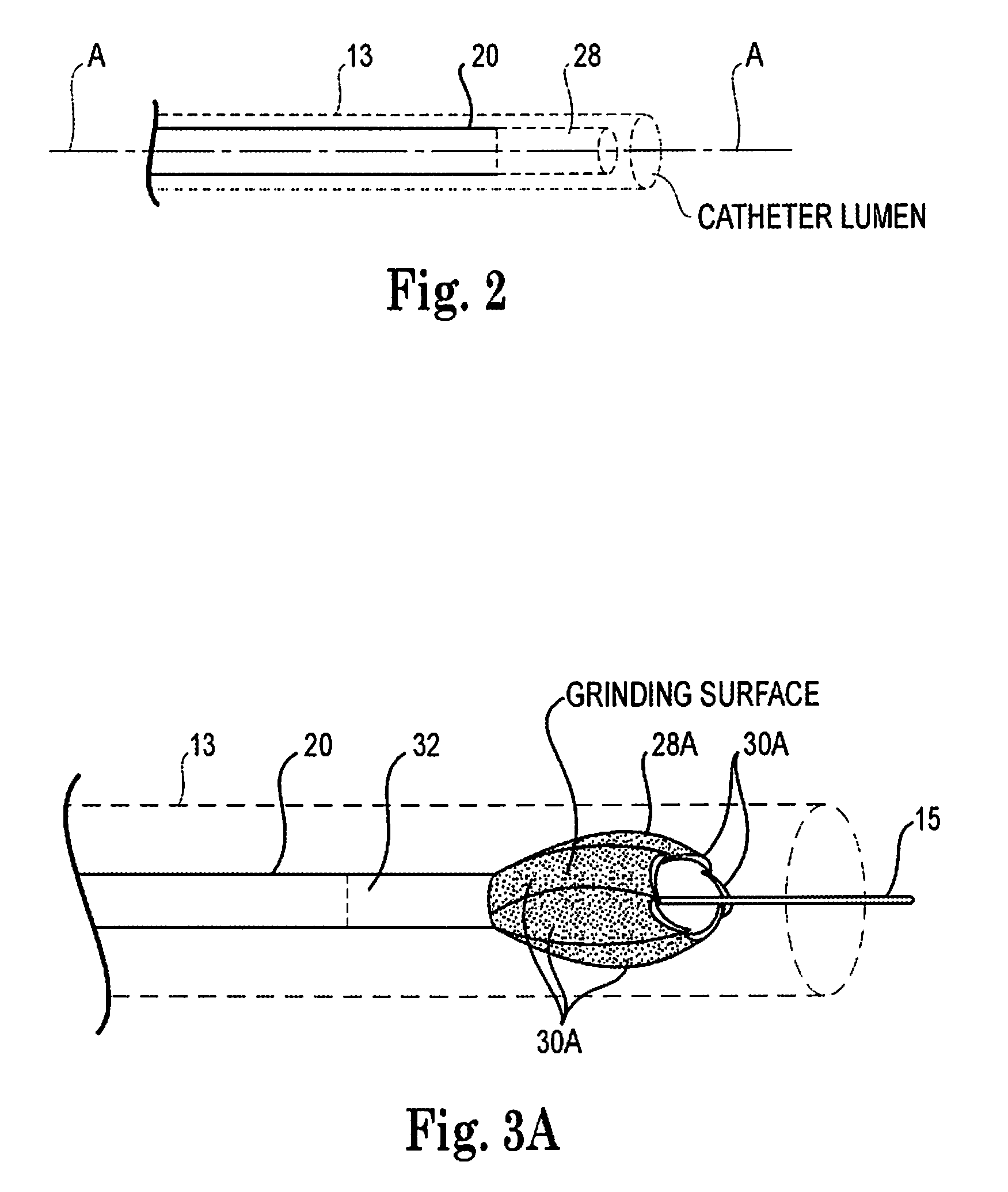 Atherectomy device, system and method having a bi-directional distal expandable ablation element