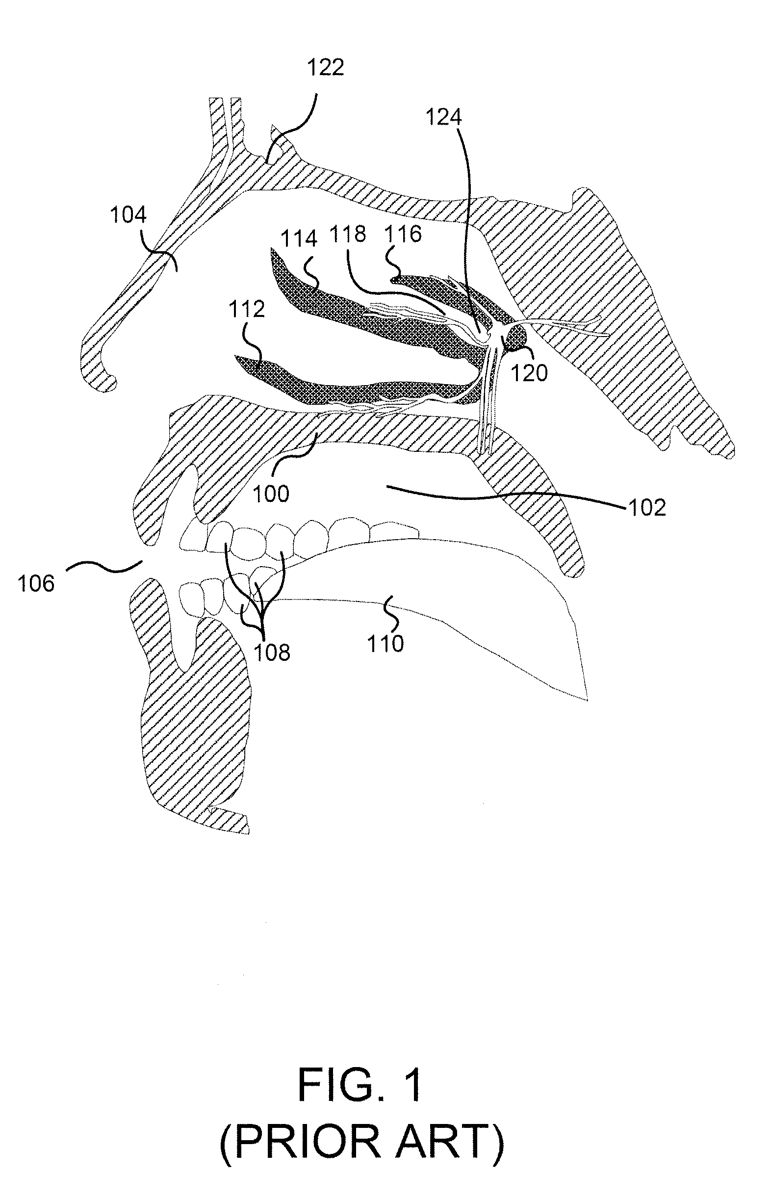 Apparatus, system, and method for treating atypical headaches