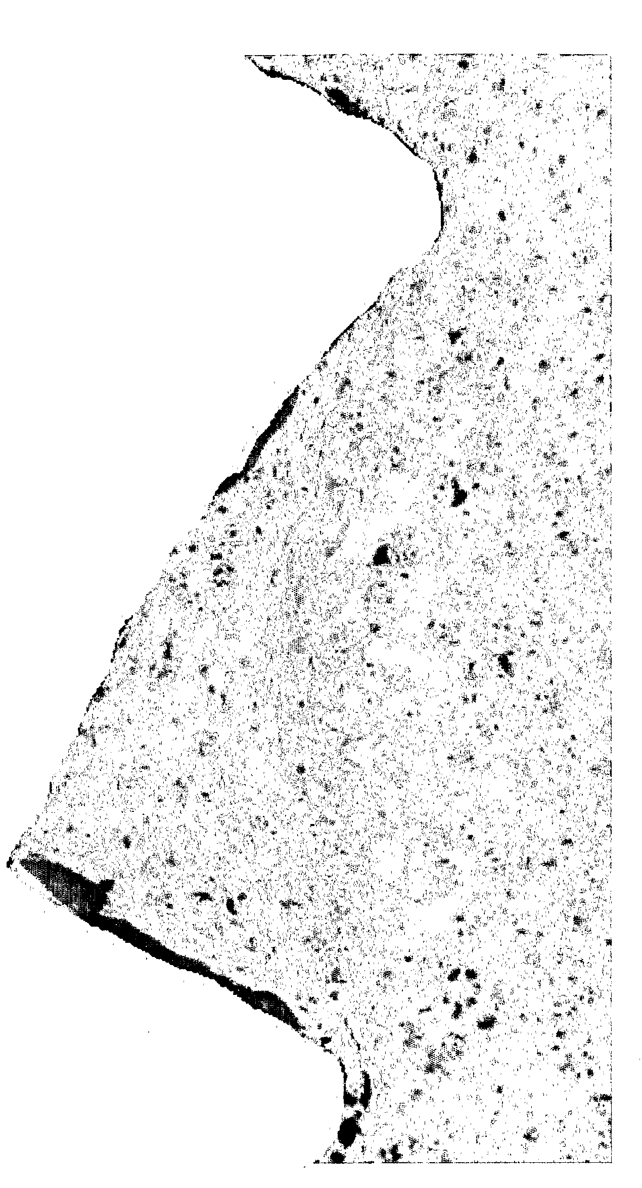 Method for Preparing Endosseous Implants Anatase Titanium Dioxide Coating