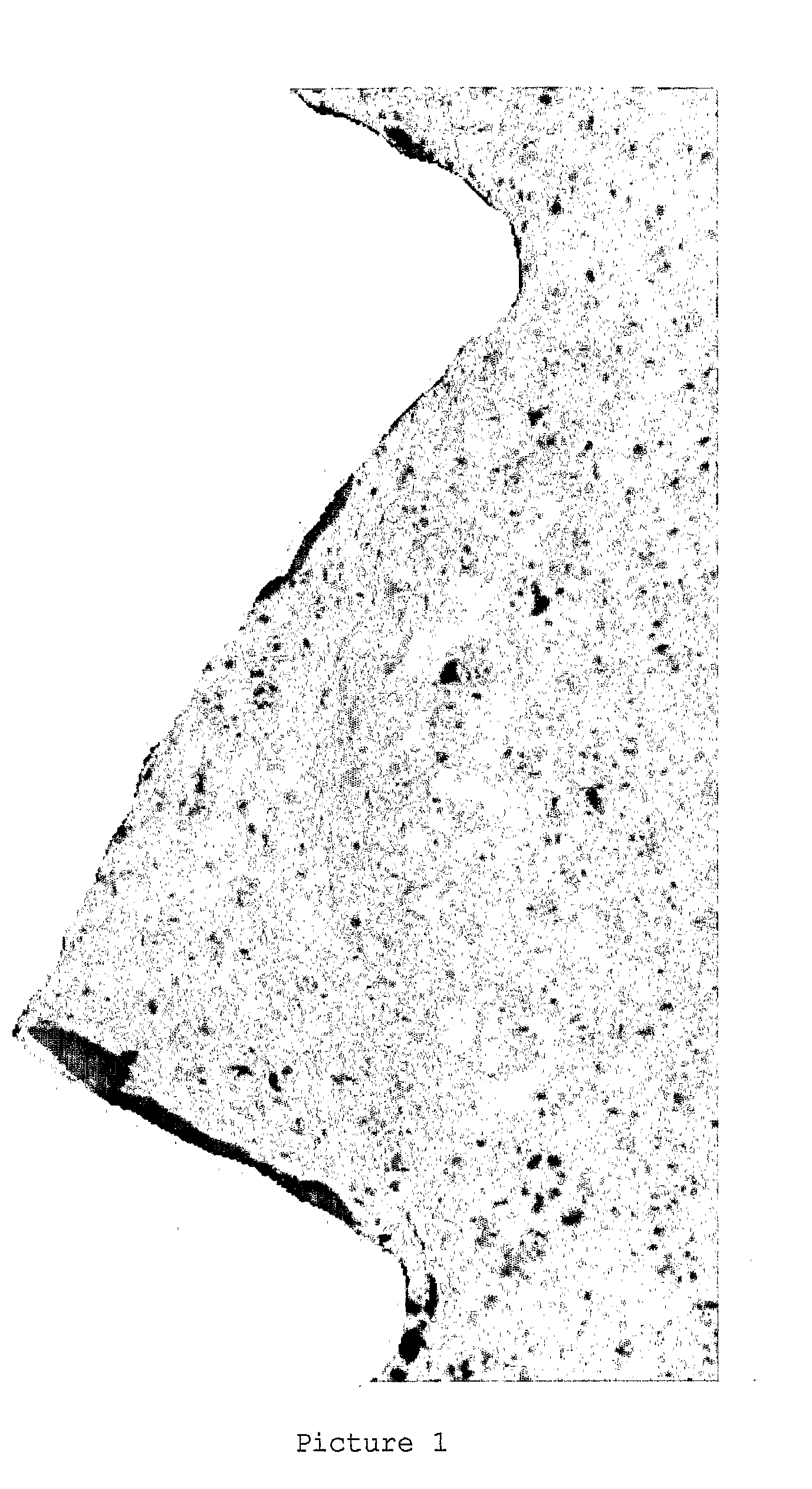 Method for Preparing Endosseous Implants Anatase Titanium Dioxide Coating