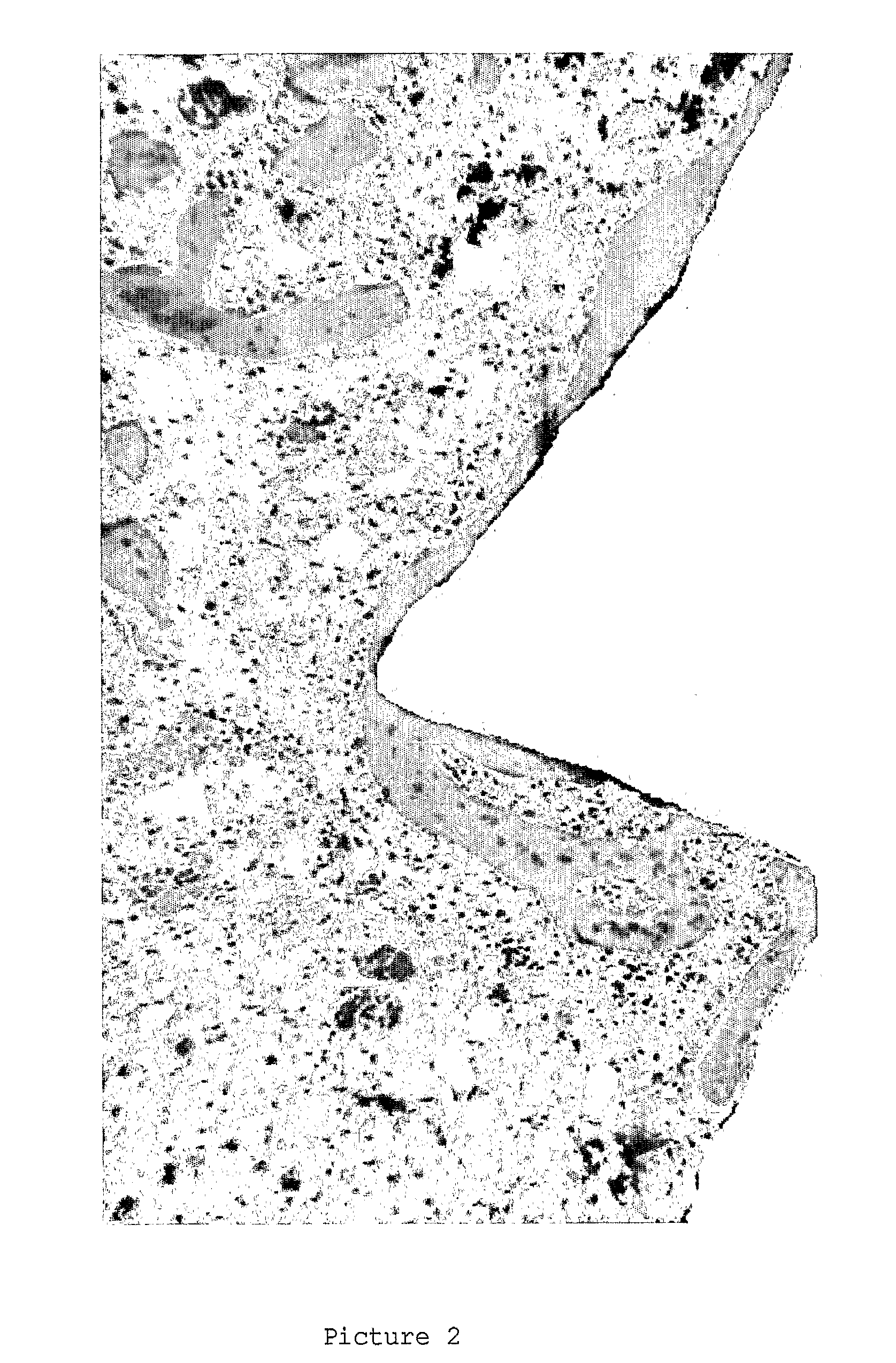 Method for Preparing Endosseous Implants Anatase Titanium Dioxide Coating