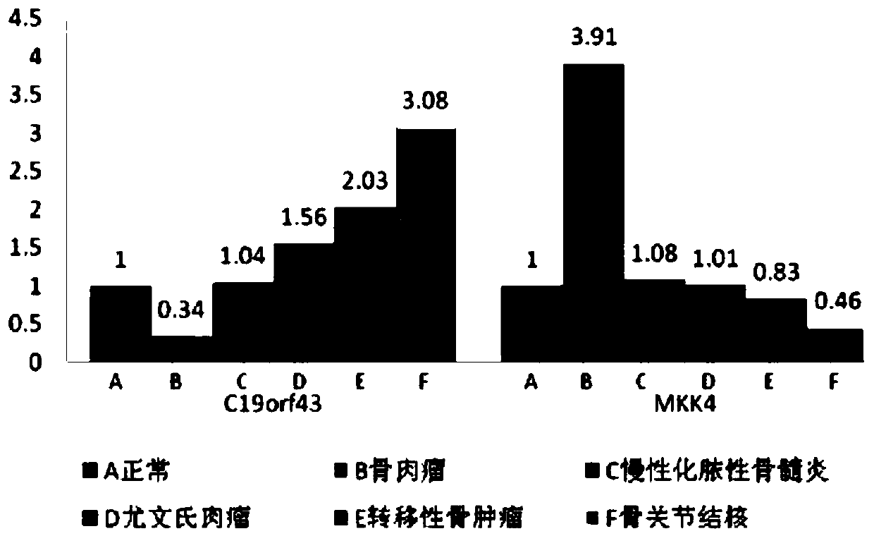 Exosome protein for osteosarcoma diagnosis and instant detecting method thereof