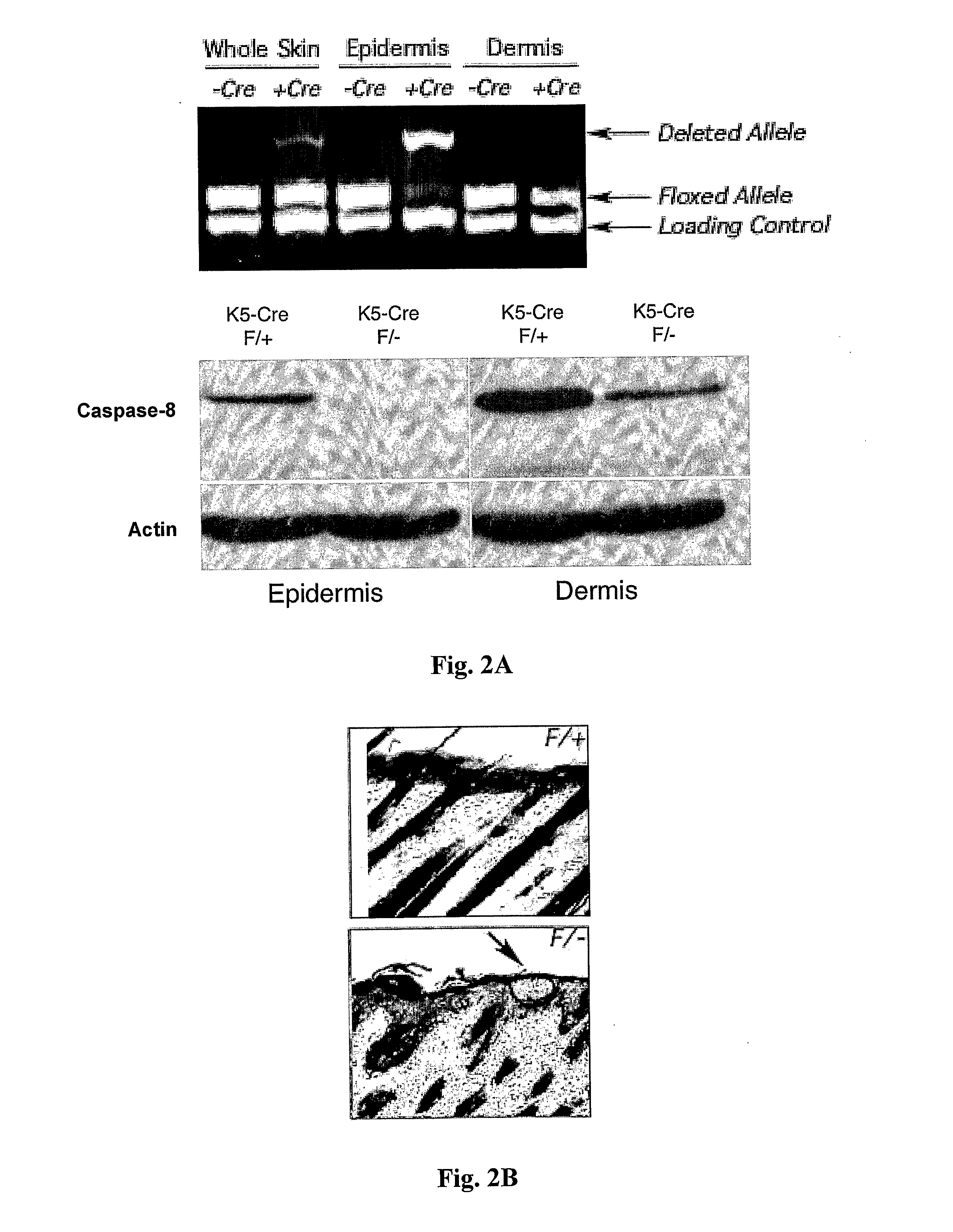 Pharmaceutical Compositions and Diagnostic Methods for Inflammatory Skin Diseases, Disorders or Conditions