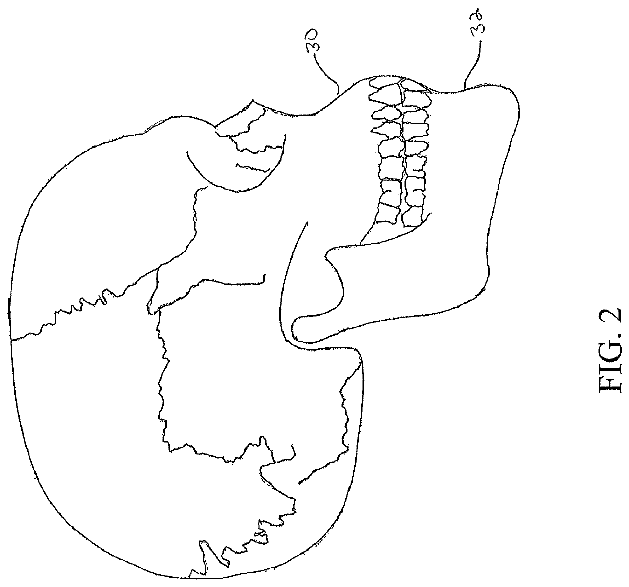 System and method for sensor driven intelligent oral appliance