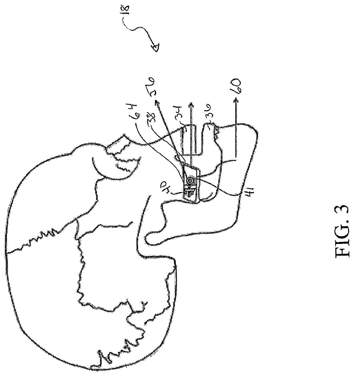 System and method for sensor driven intelligent oral appliance