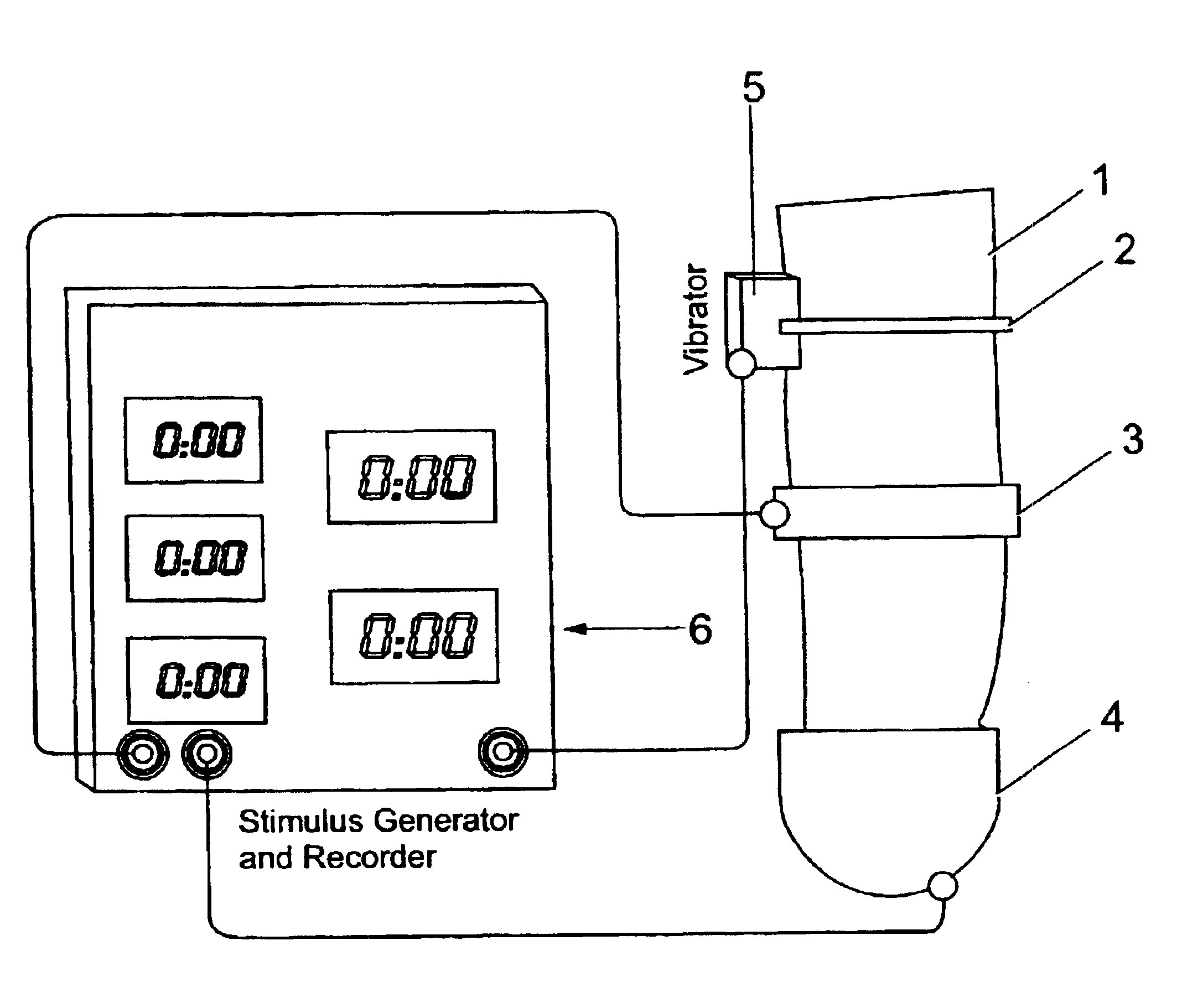 Apparatus and method to assist in the diagnosis of premature ejaculation