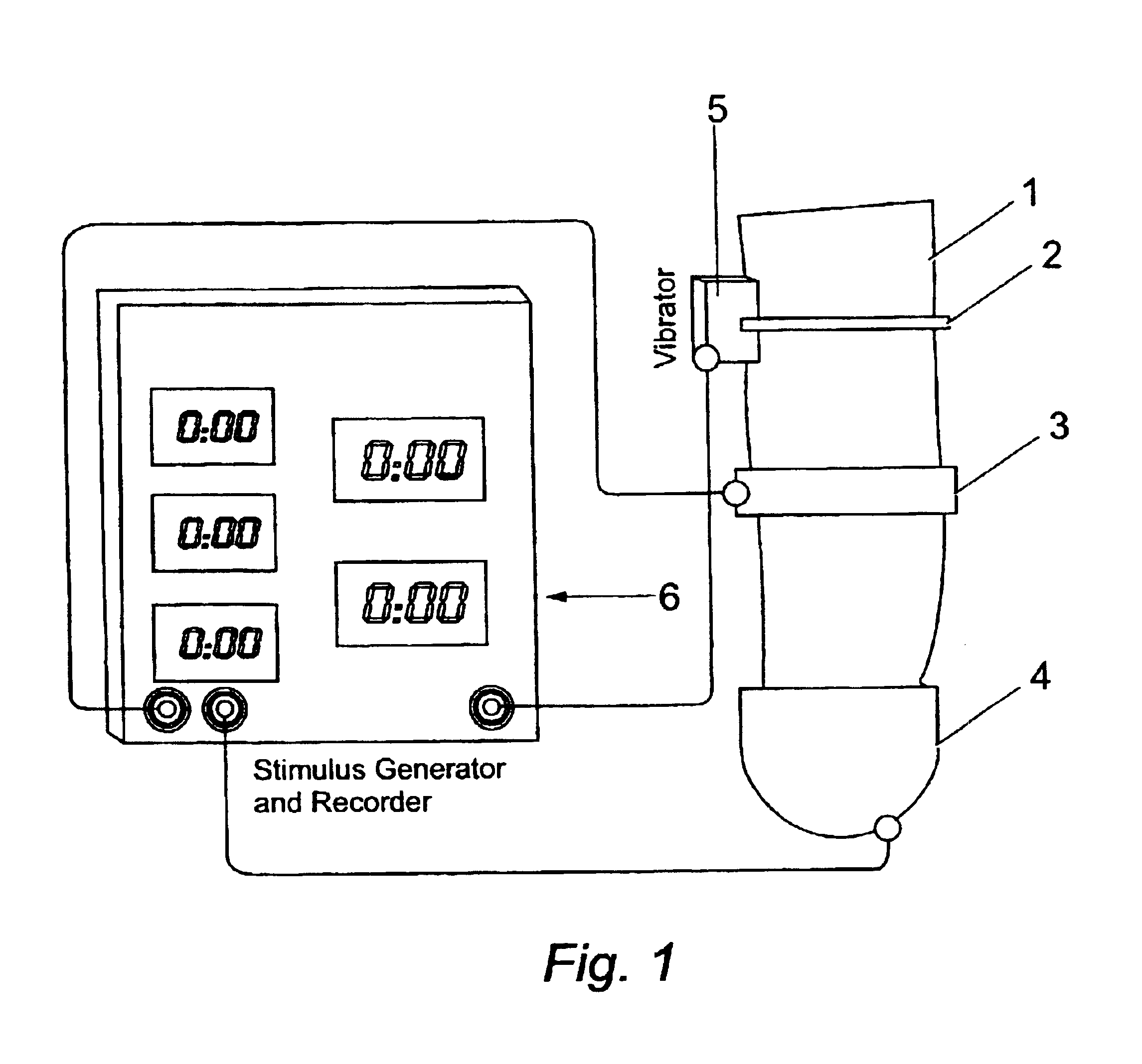 Apparatus and method to assist in the diagnosis of premature ejaculation