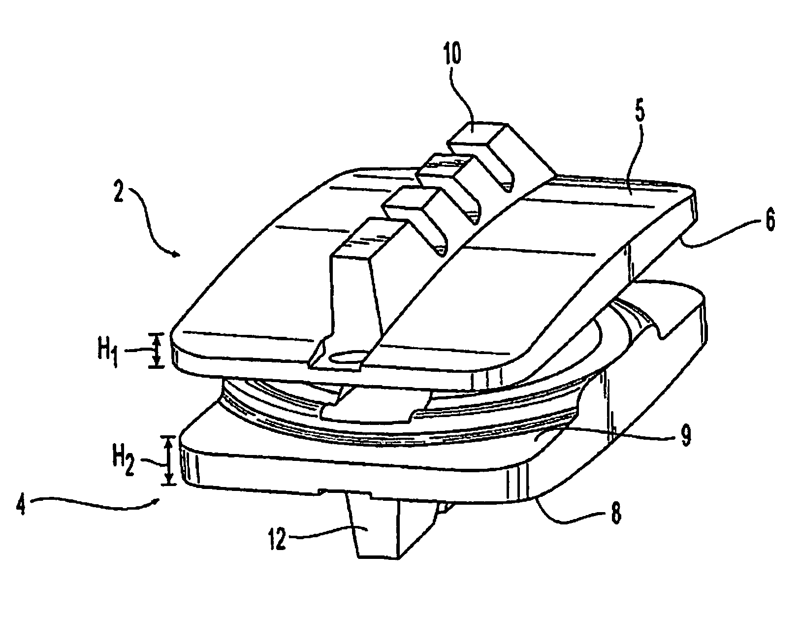 Prosthetic Spinal Disc Replacement and Methods Thereof