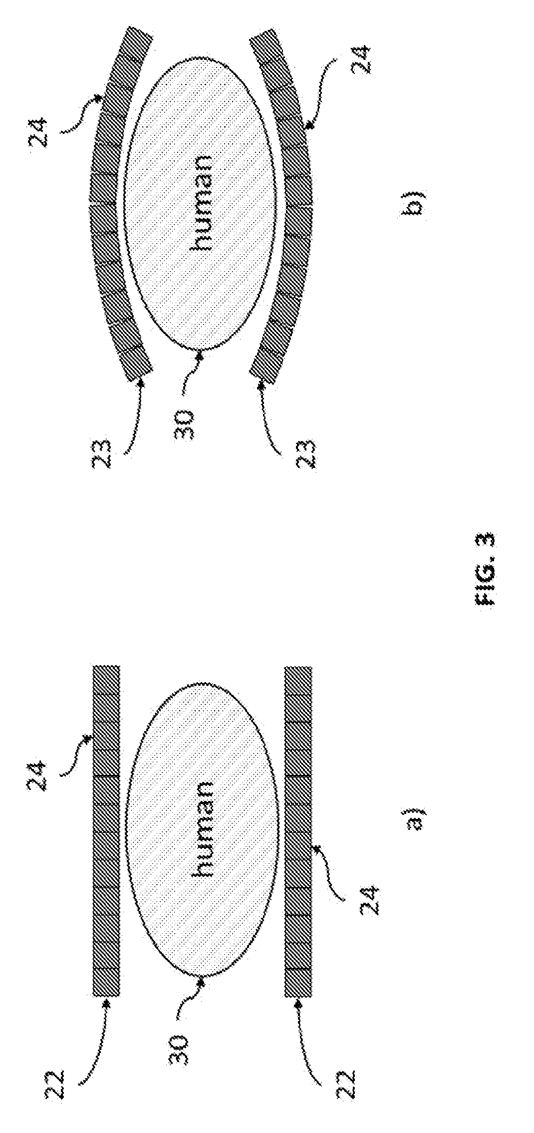 Transformable gamma cameras