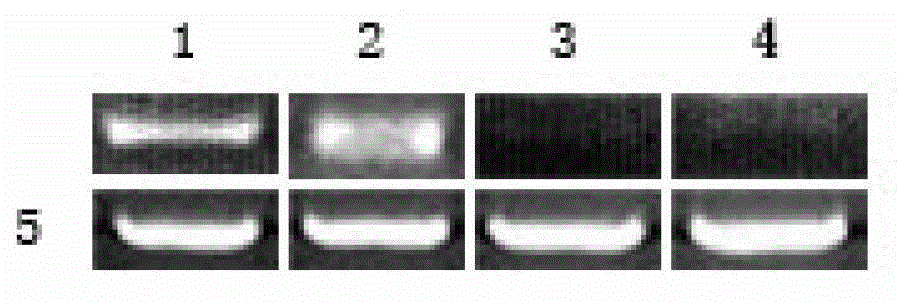 Method for building immortalized preadipocytes of chicken