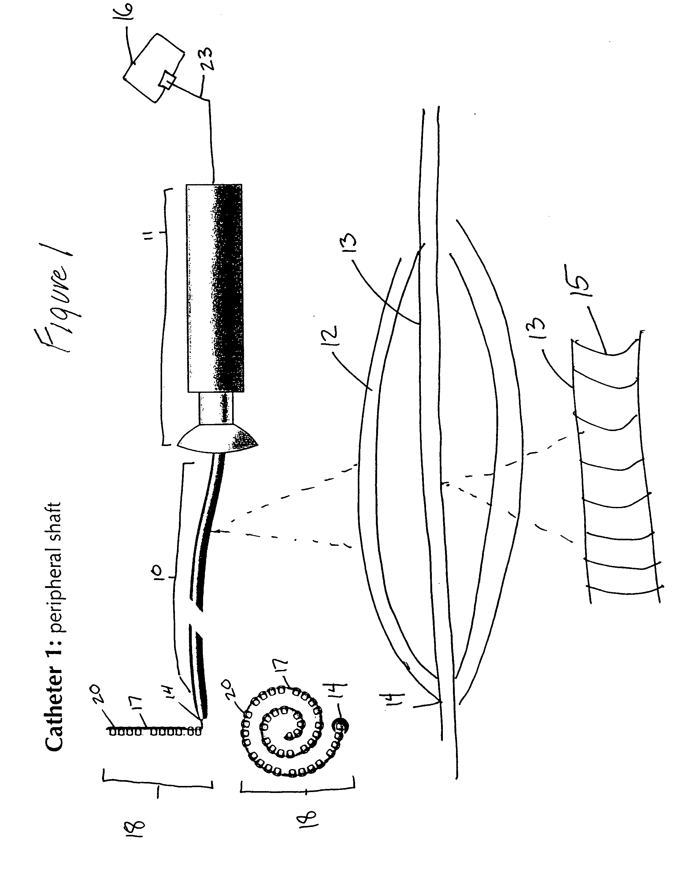 Ablation catheters