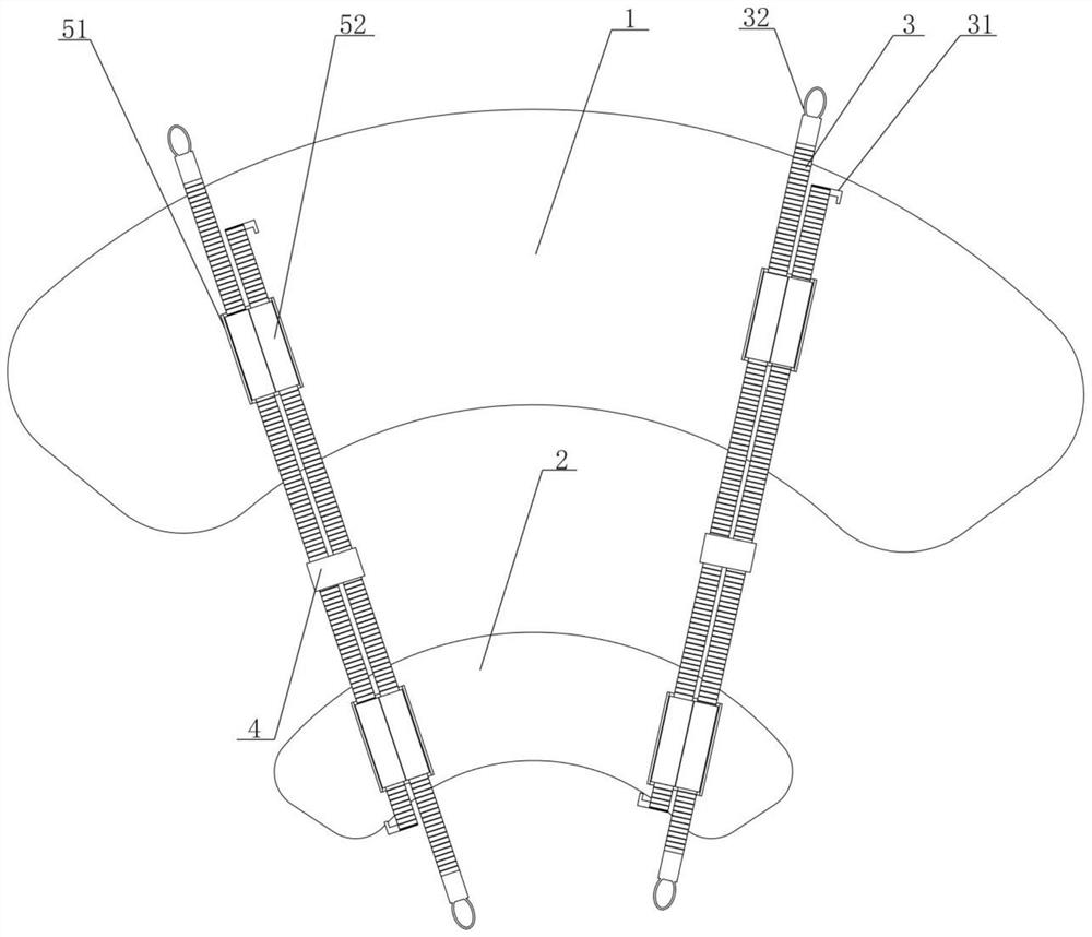 Aareola incision closing device