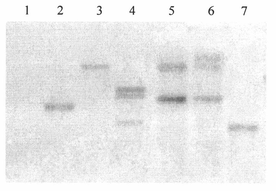 Method for cultivating anti-cyanosis transgenic cotton and special expression vector thereof