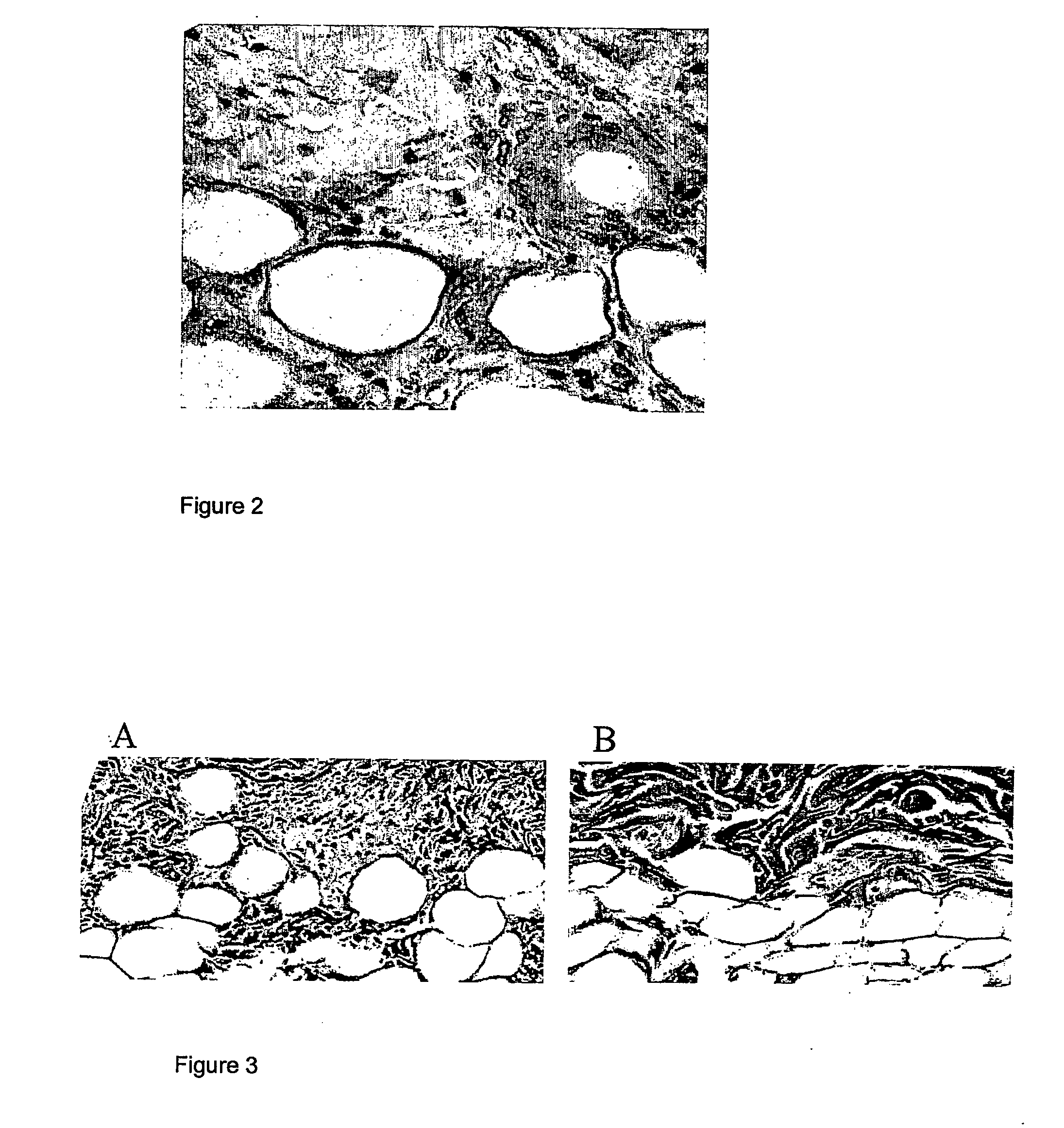 Carbohydrate-based anti-wrinkle and tissue remodelling compounds