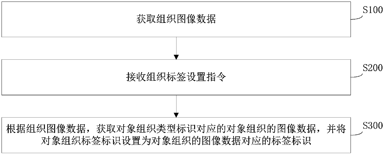 Tissue image processing method and device, storage medium and computer equipment