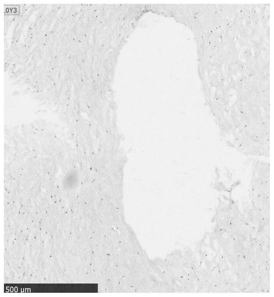 Preparation and cryopreservation method and application of human placental subchorionic large blood vessel tissue