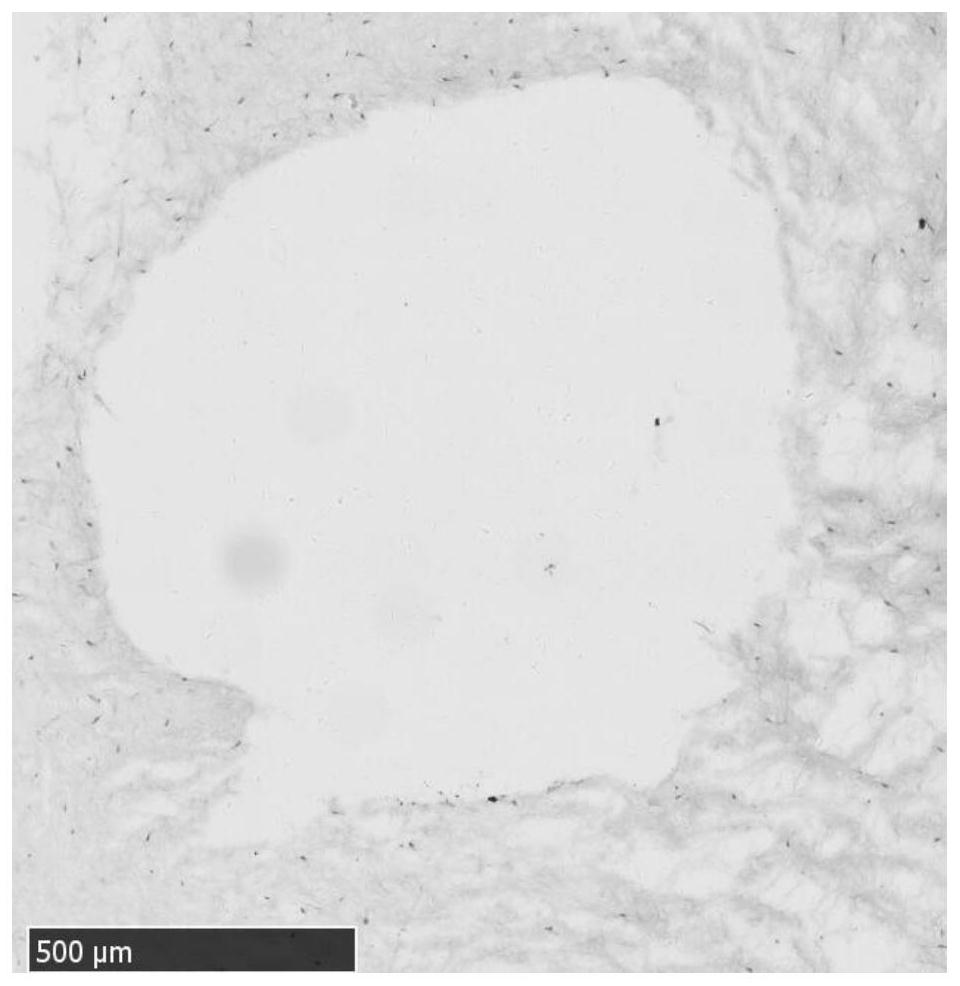 Preparation and cryopreservation method and application of human placental subchorionic large blood vessel tissue